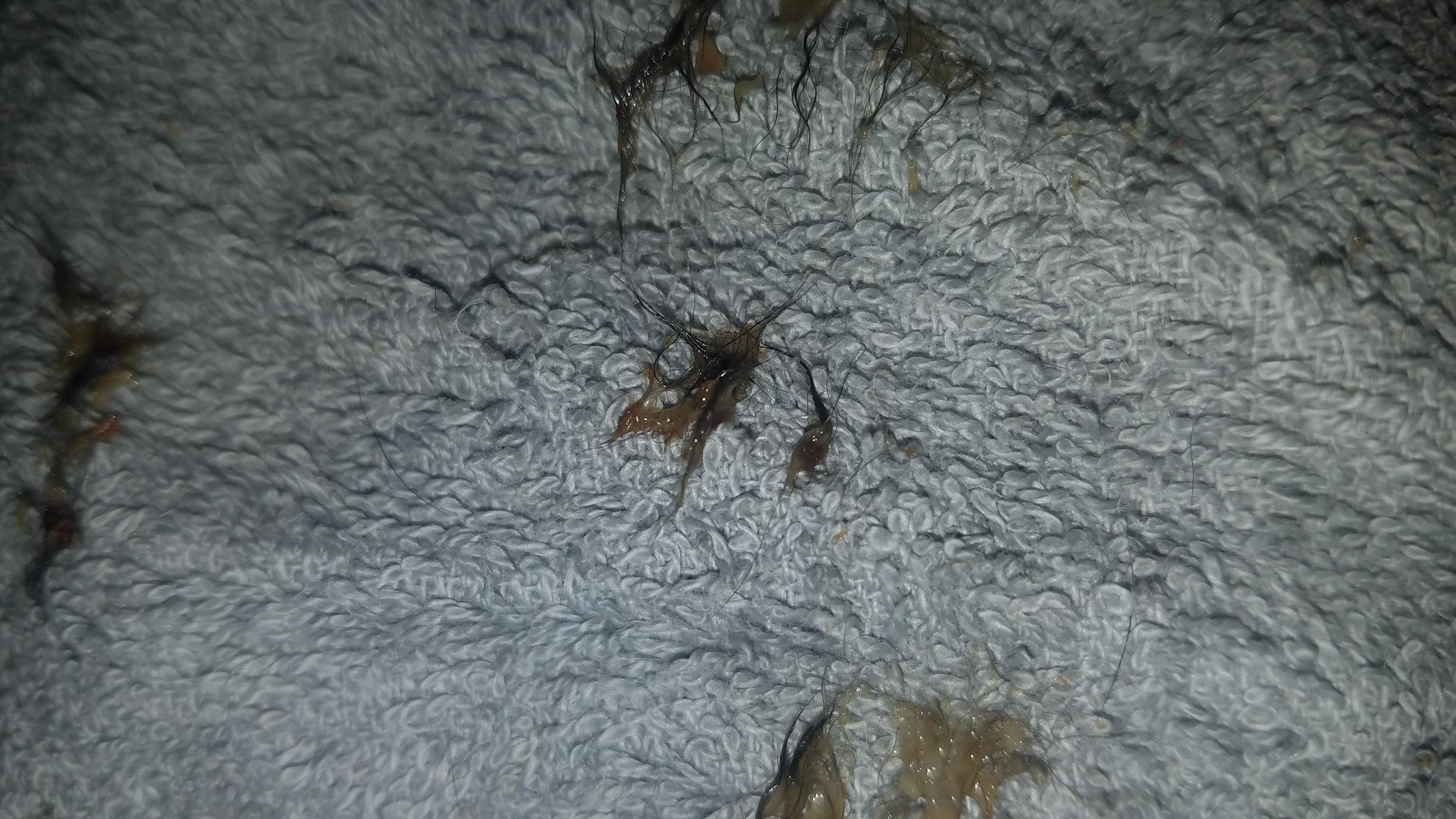 Question details sensitive content