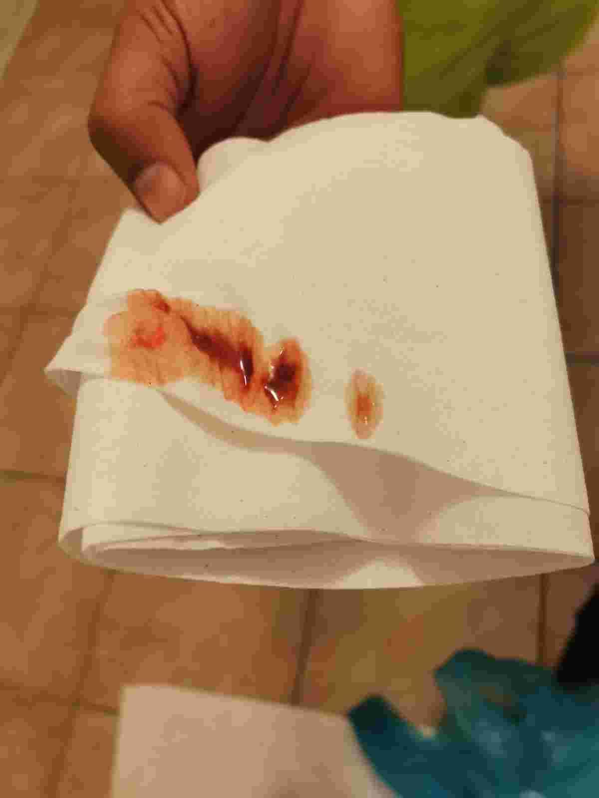 Question details sensitive content