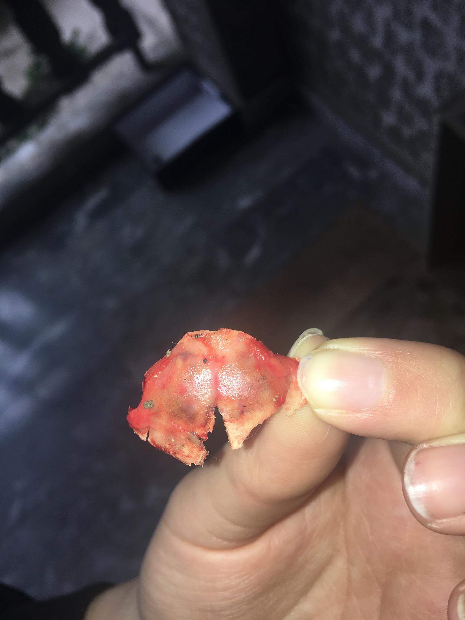 Question details sensitive content