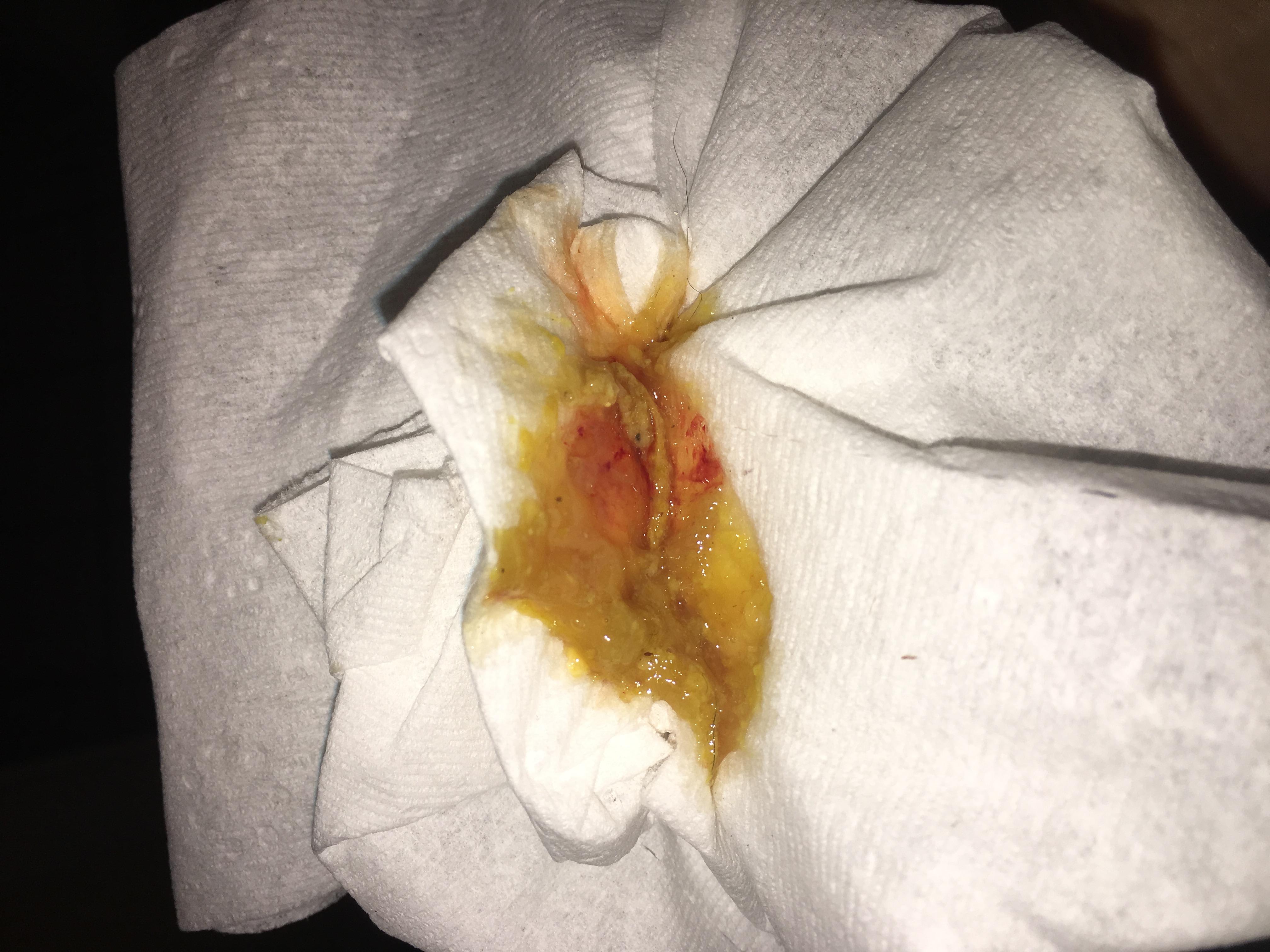 Question details sensitive content