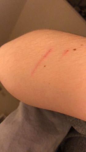 Question details sensitive content