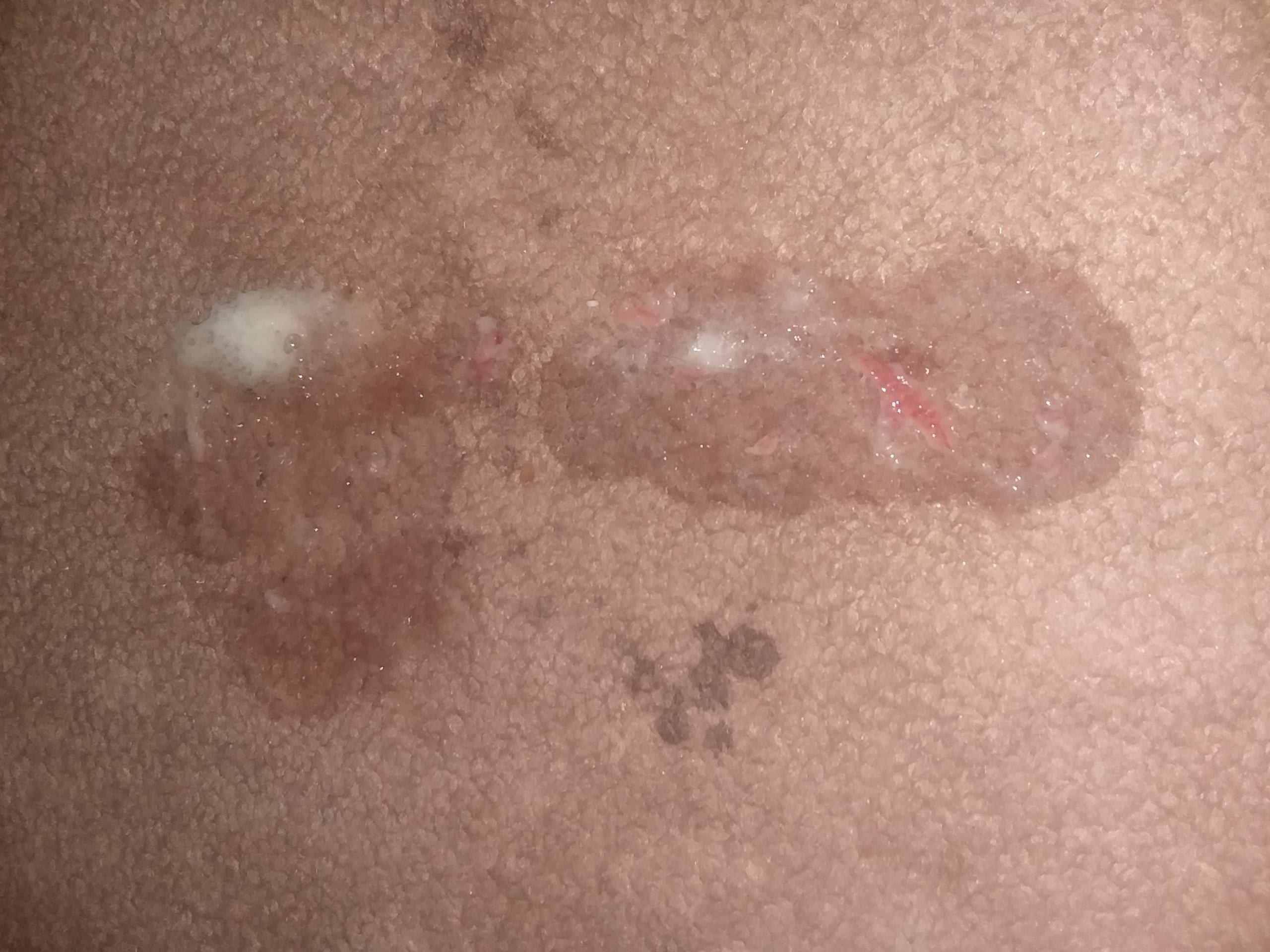 Question details sensitive content