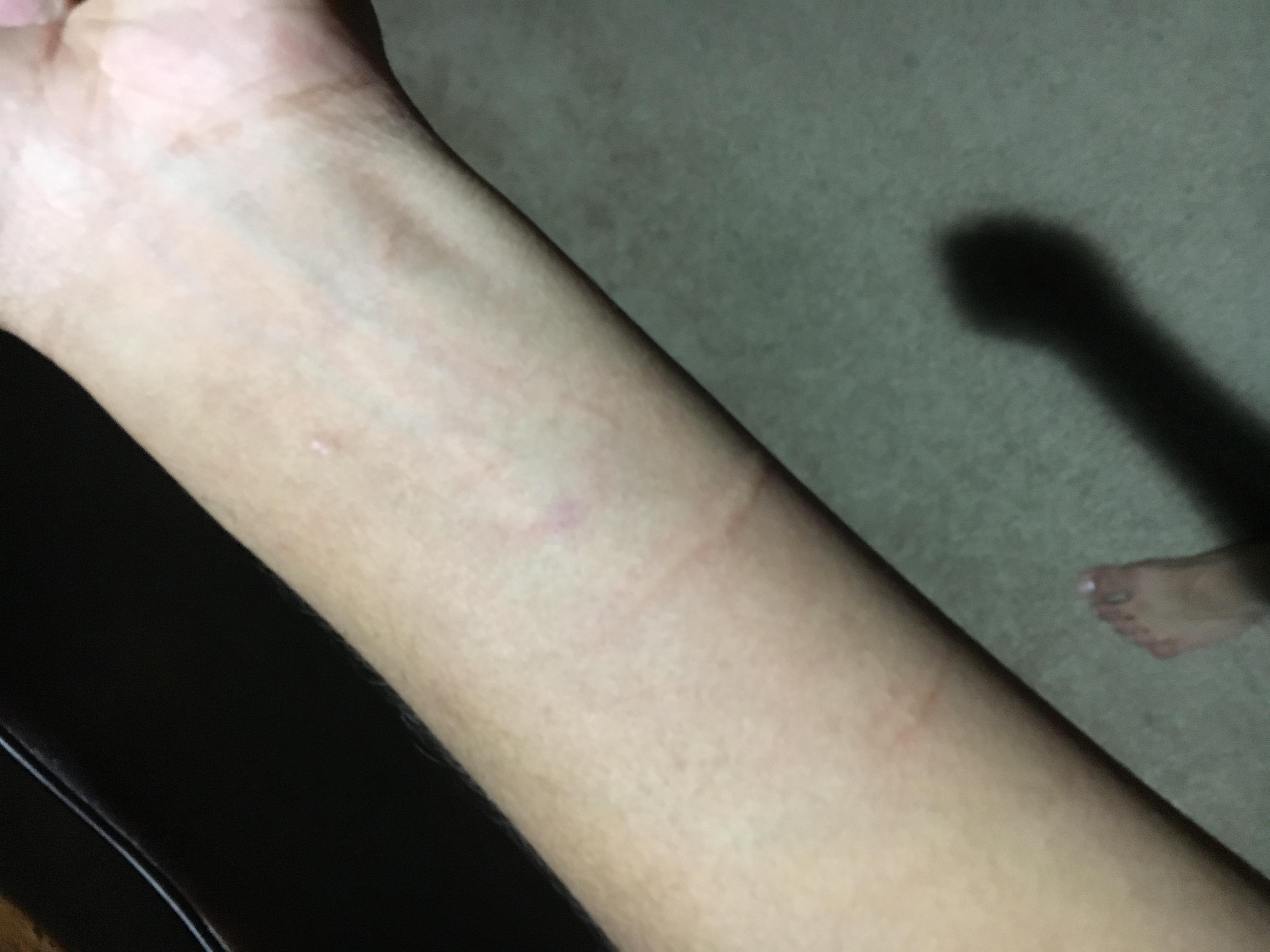 Question details sensitive content