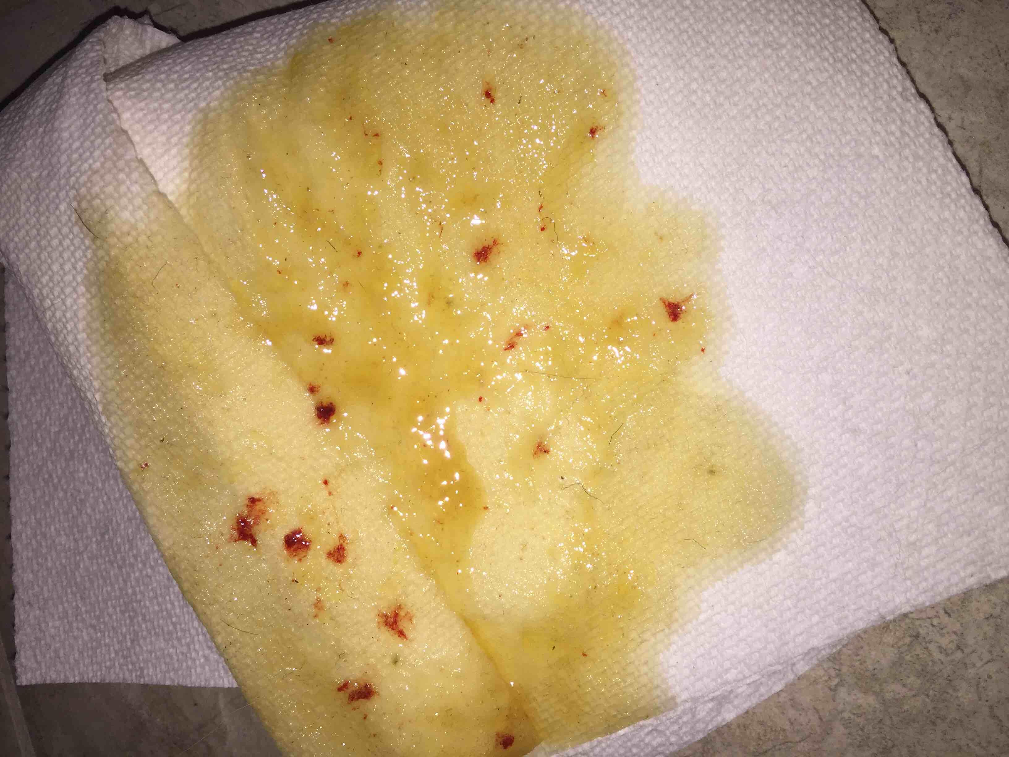 Question details sensitive content