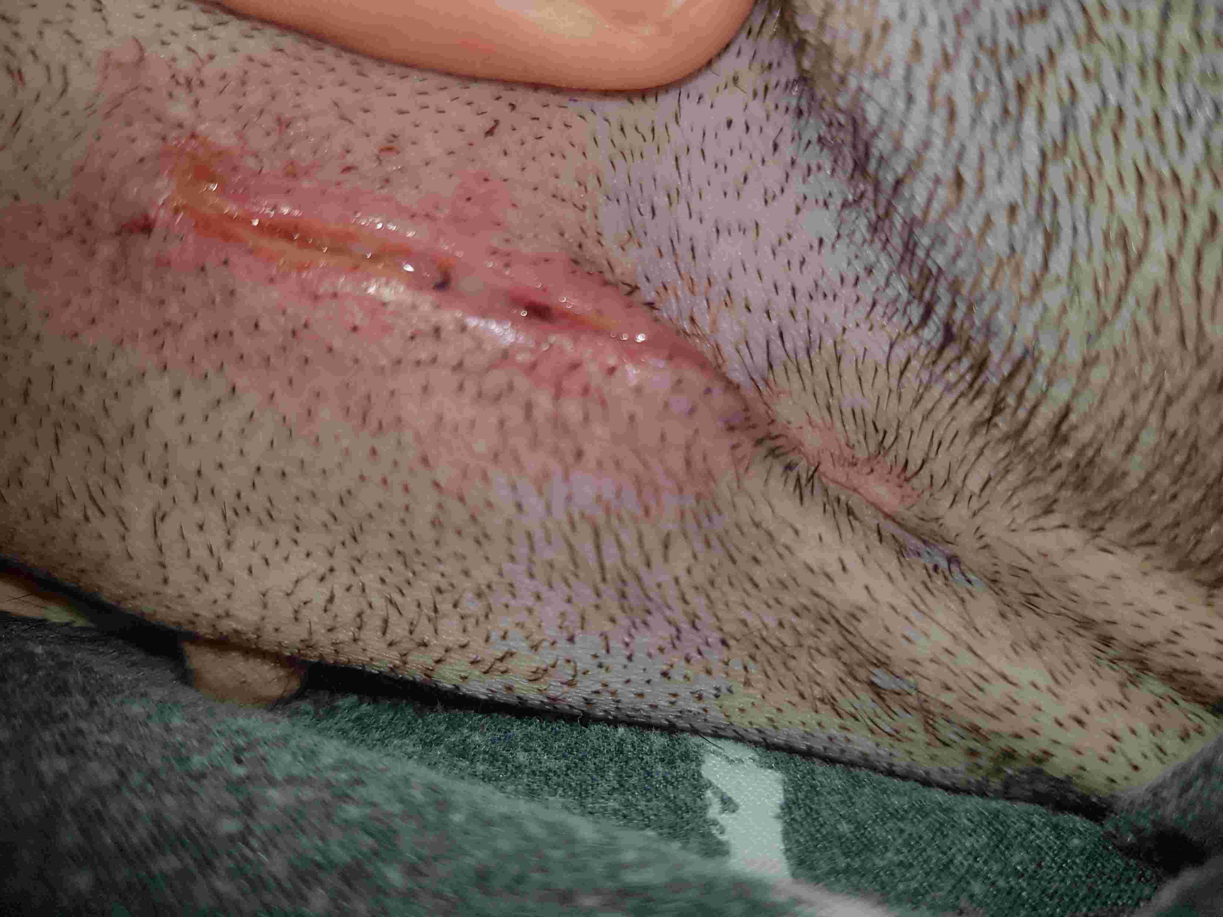 Question details sensitive content