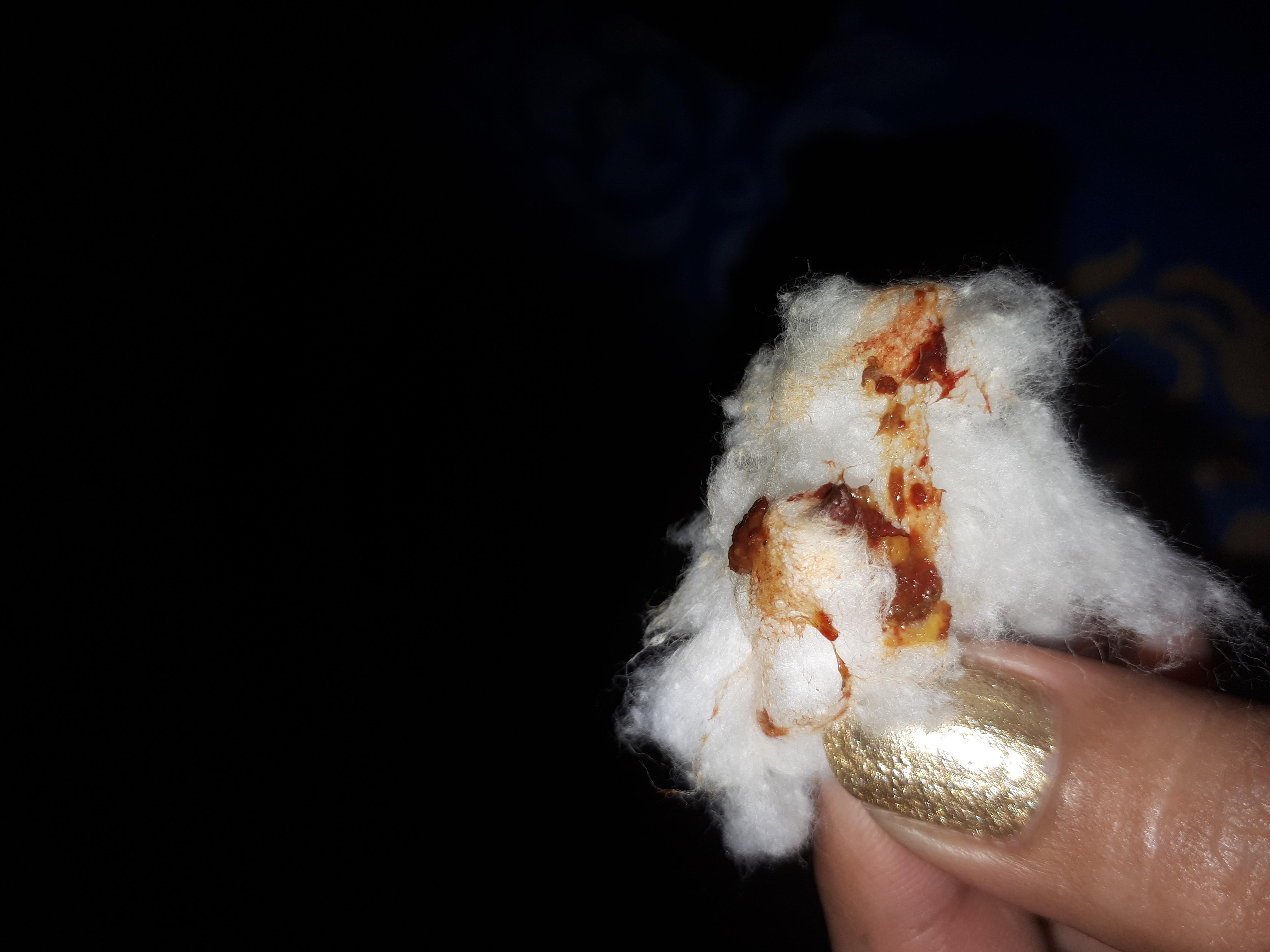 Question details sensitive content