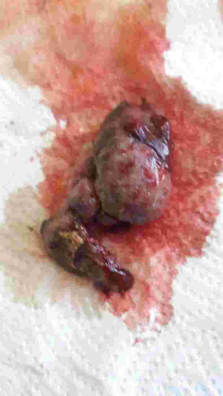 Question details sensitive content