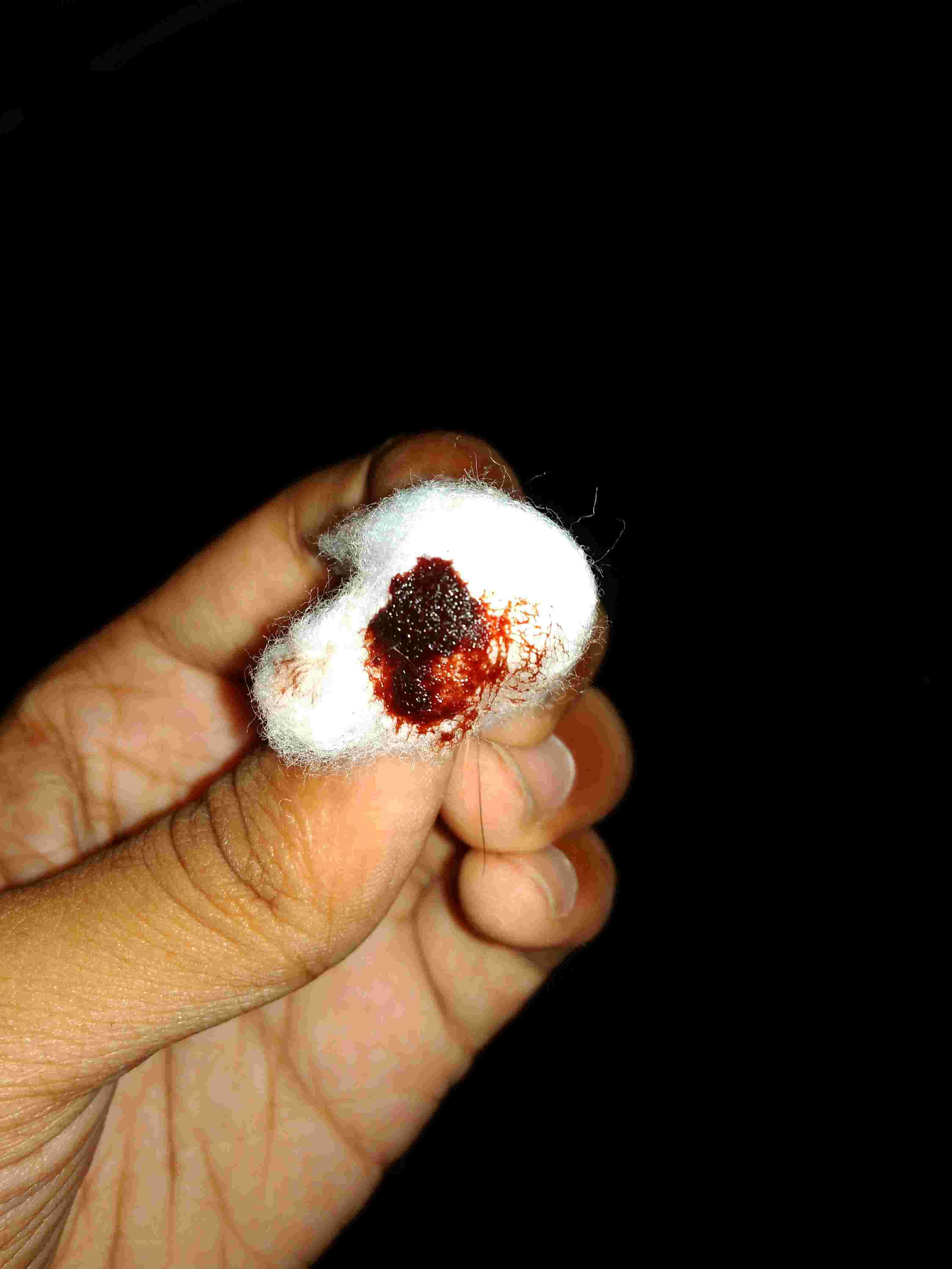 Question details sensitive content