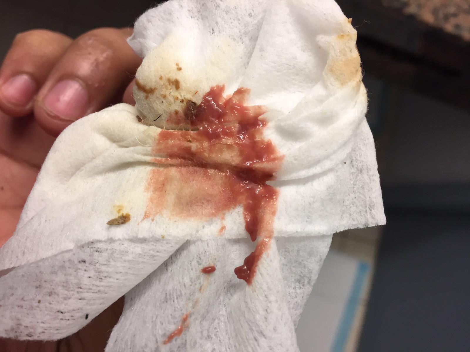 Question details sensitive content