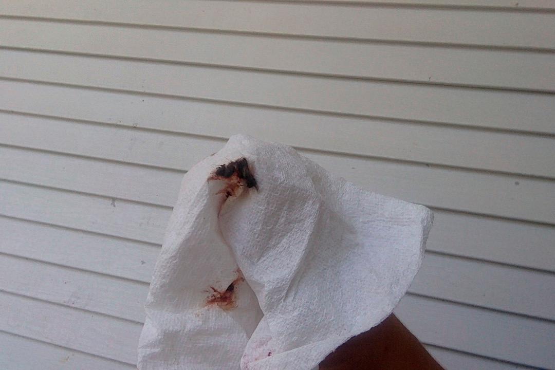 Question details sensitive content