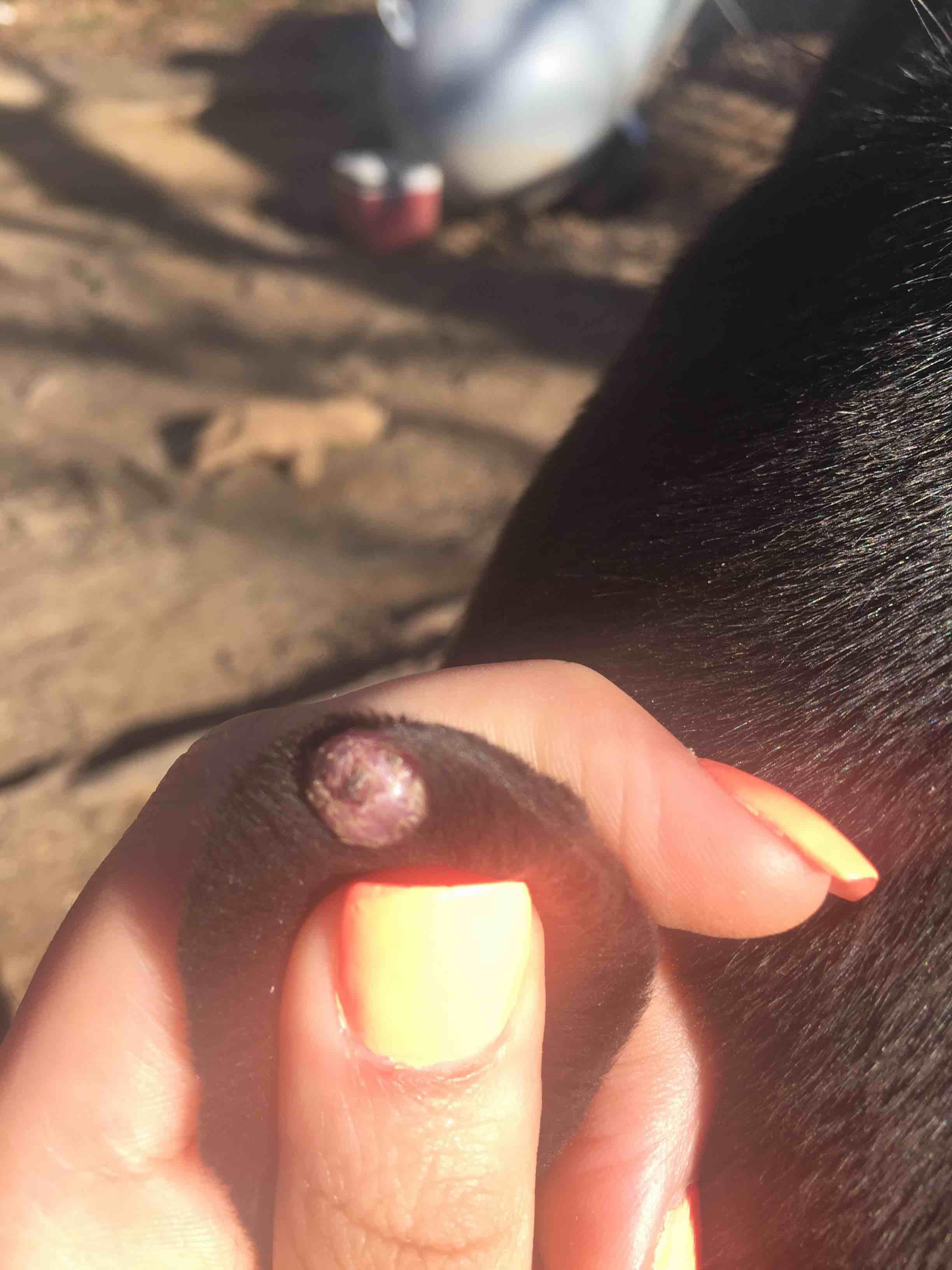 Question details sensitive content