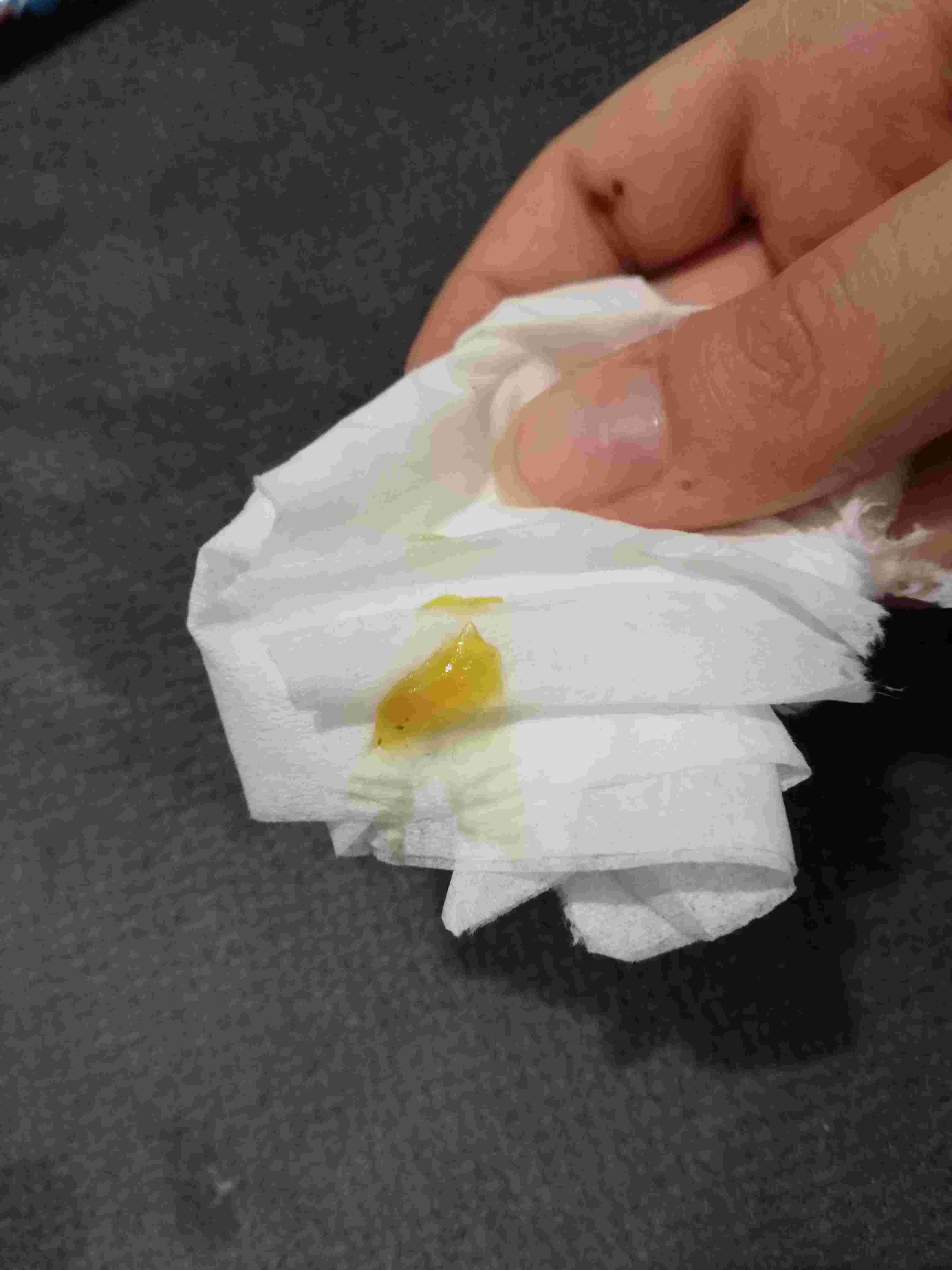 Question details sensitive content