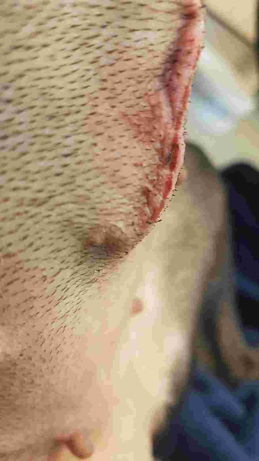 Question details sensitive content