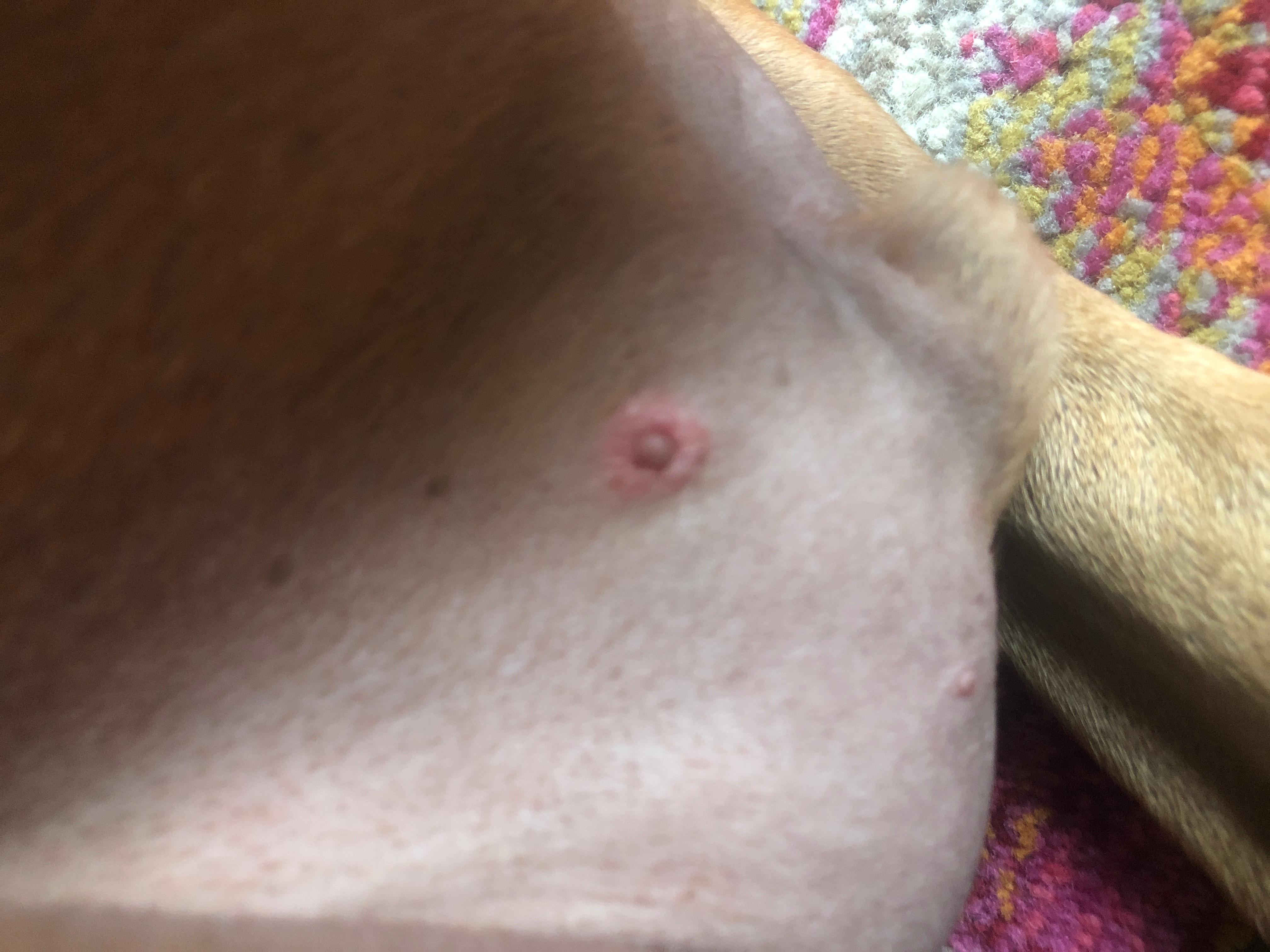 Question details sensitive content