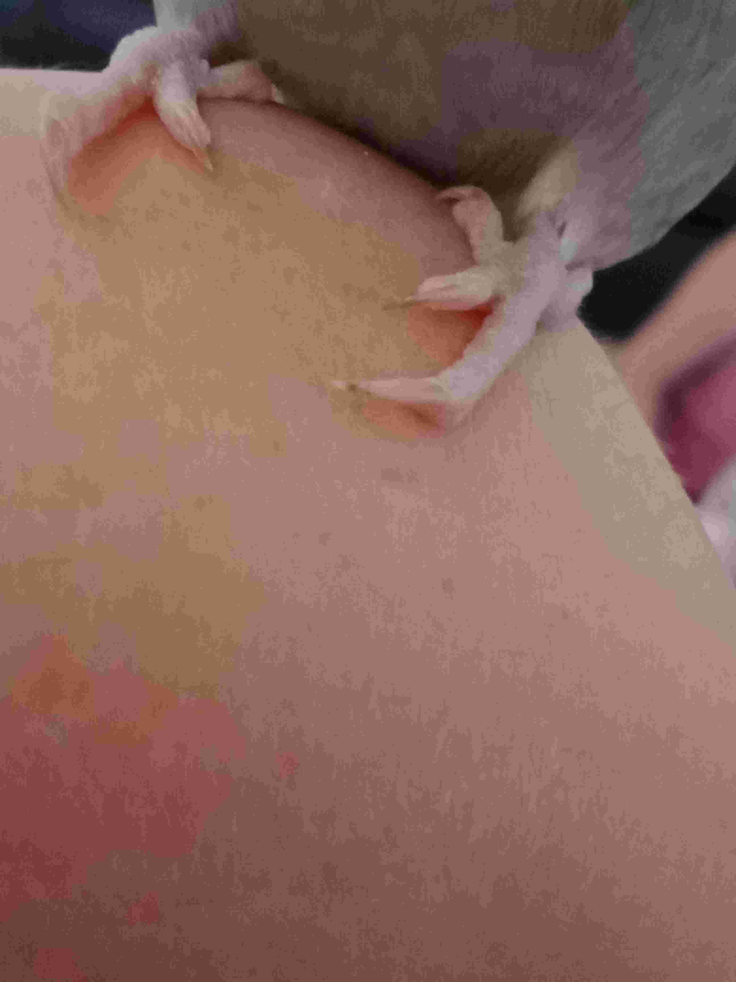 Question details sensitive content