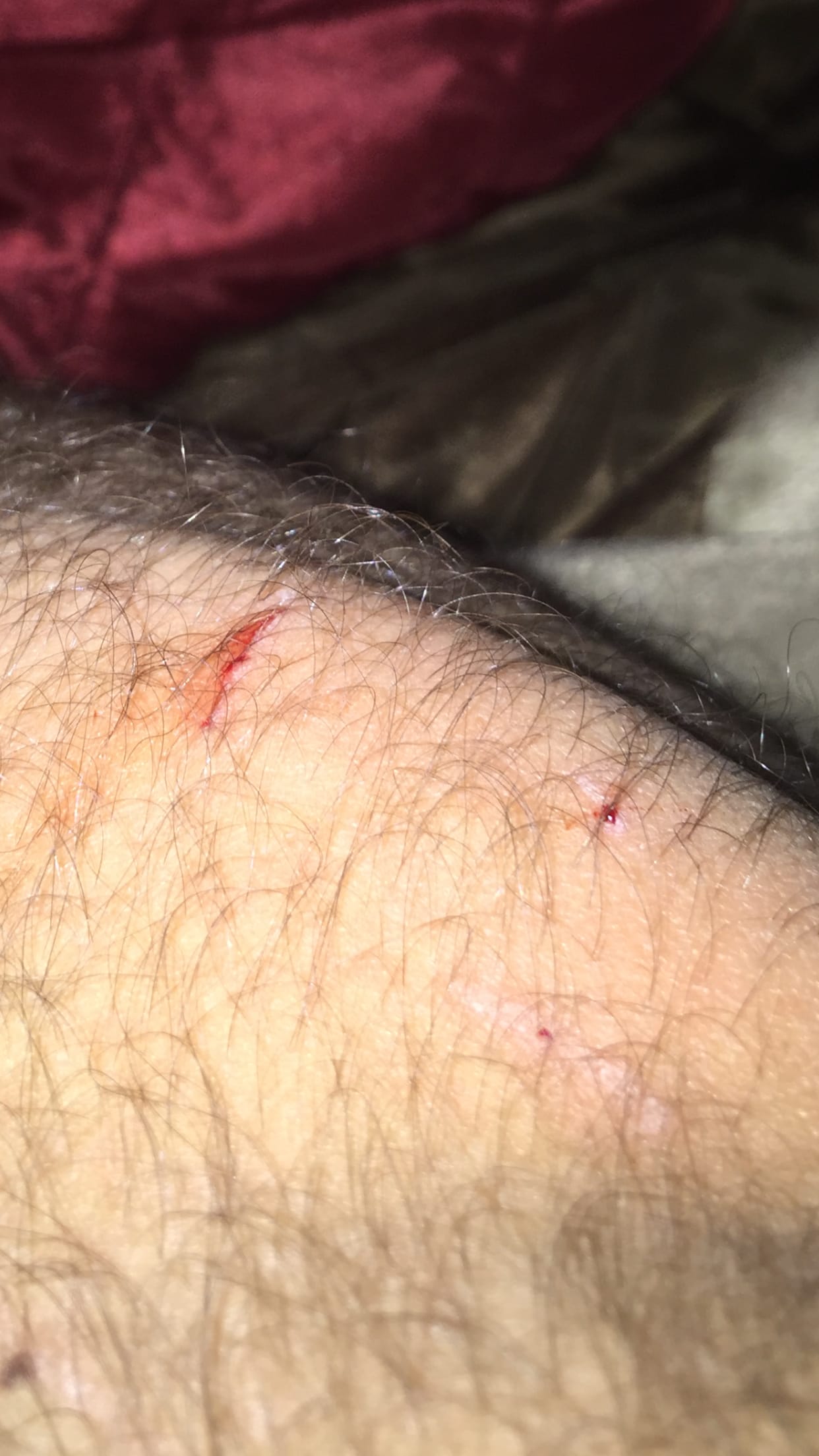 Question details sensitive content