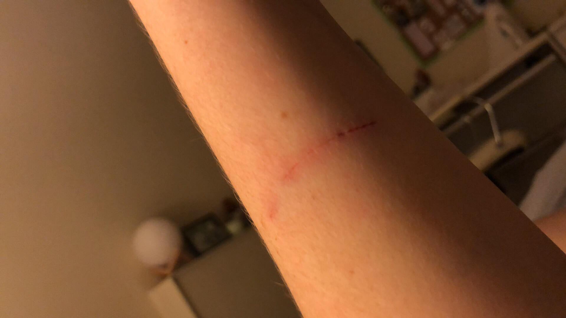 Question details sensitive content