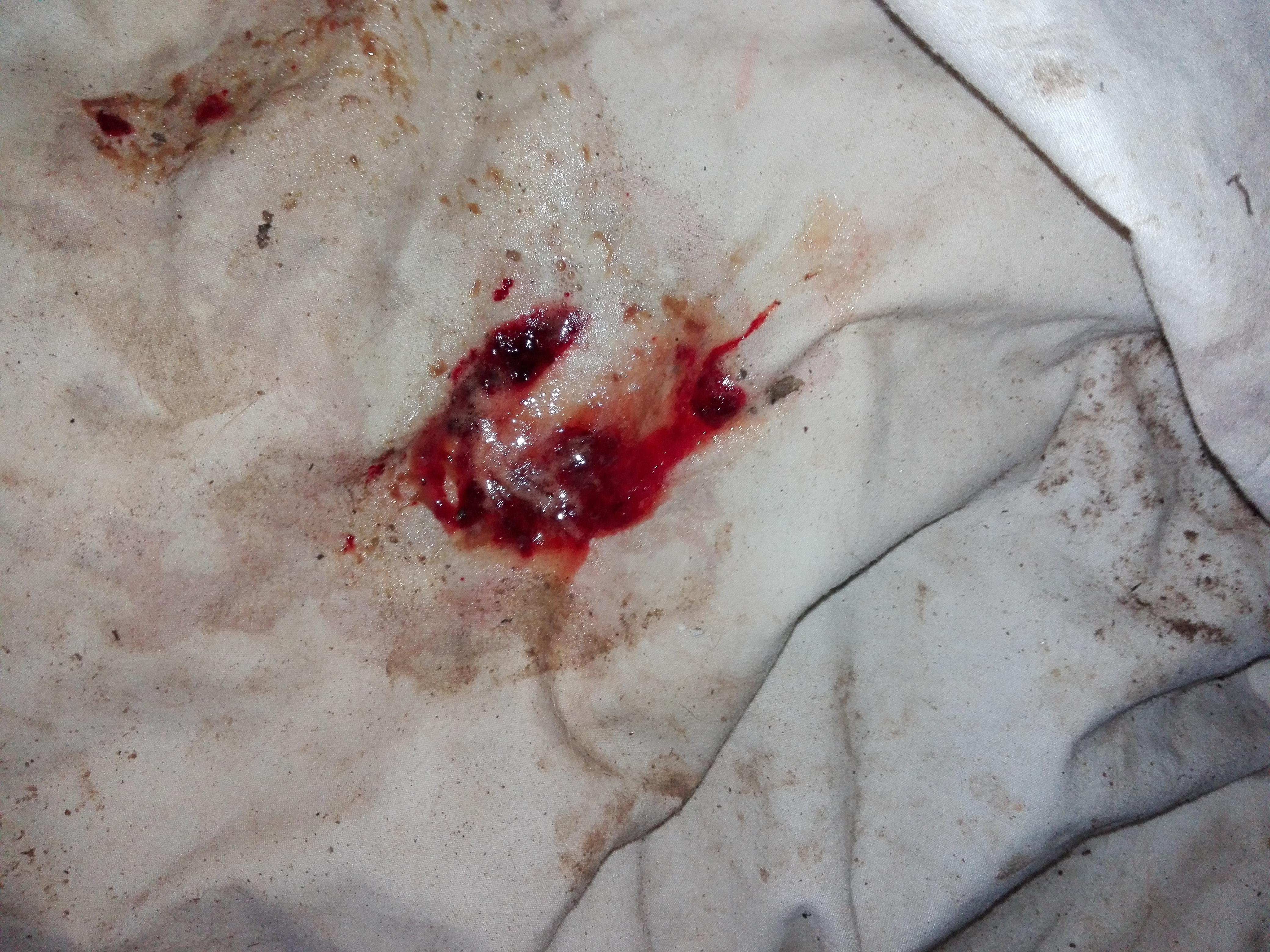 Question details sensitive content