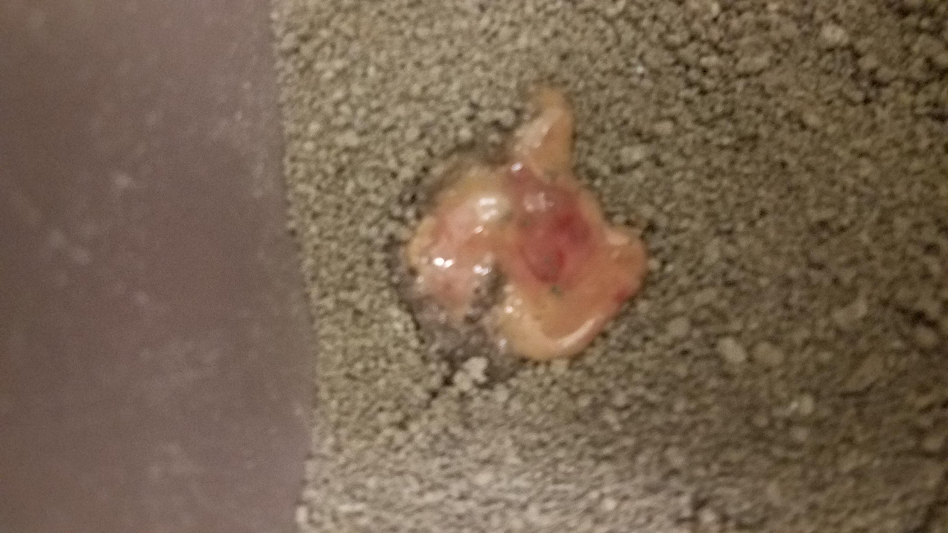 Question details sensitive content