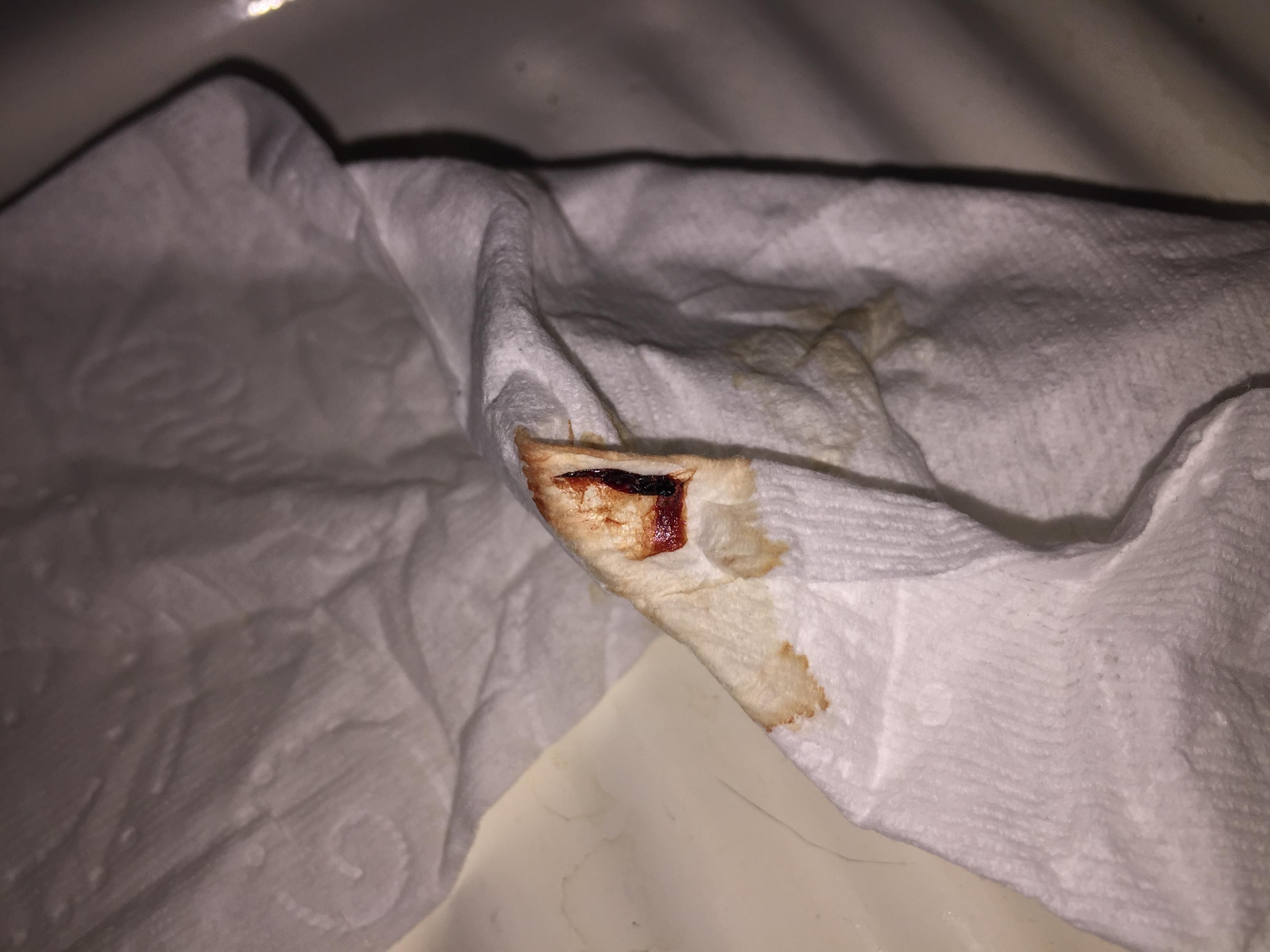 Question details sensitive content