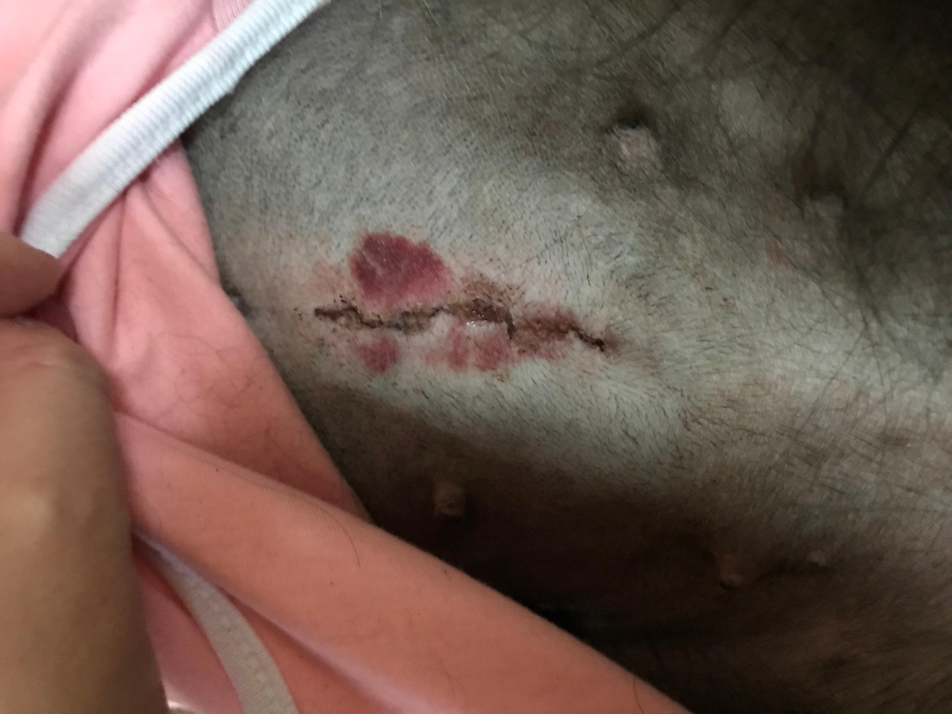 Question details sensitive content