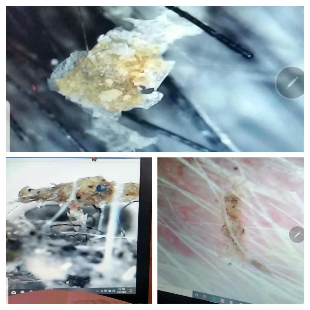 Question details sensitive content