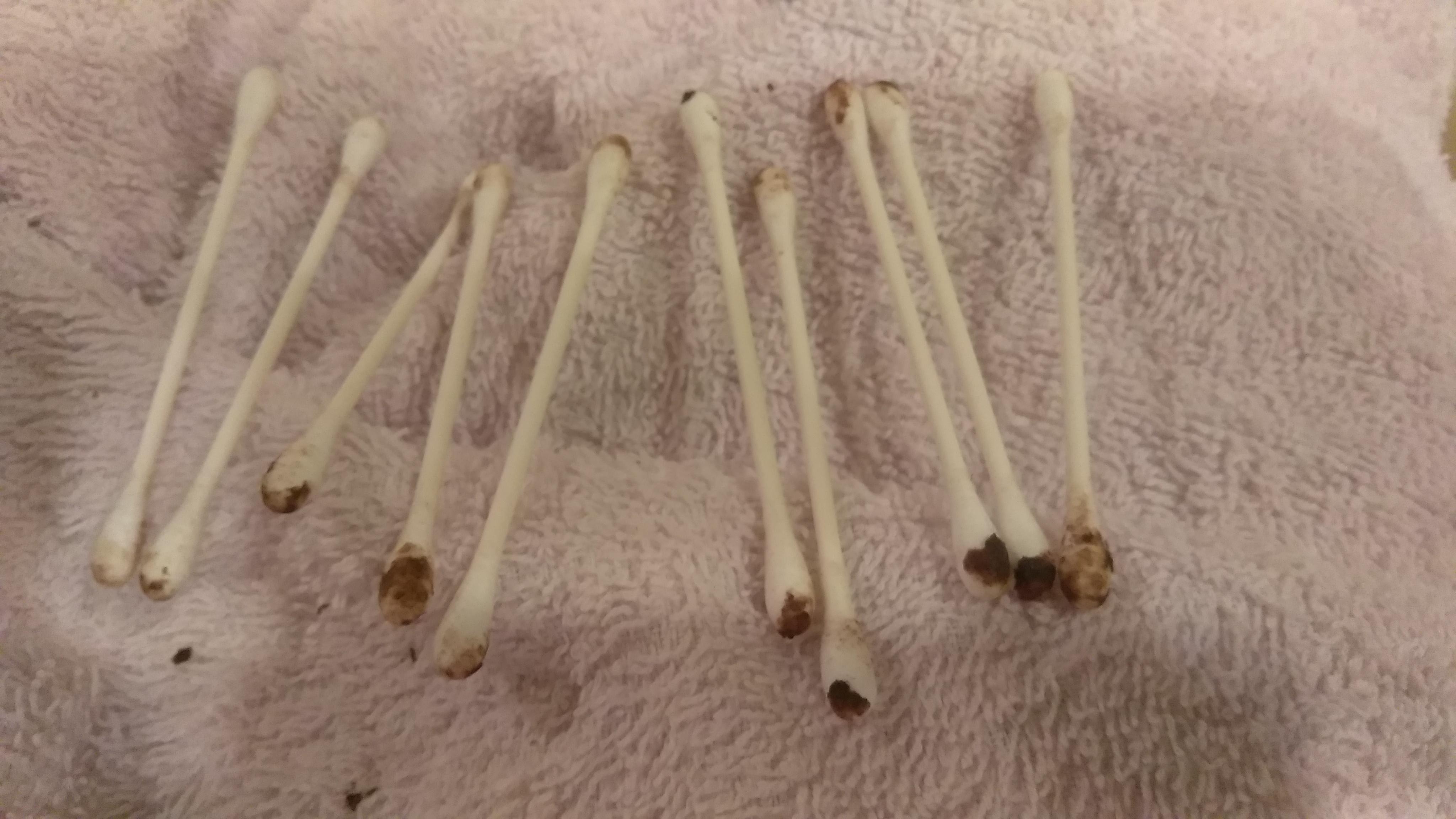 Question details sensitive content