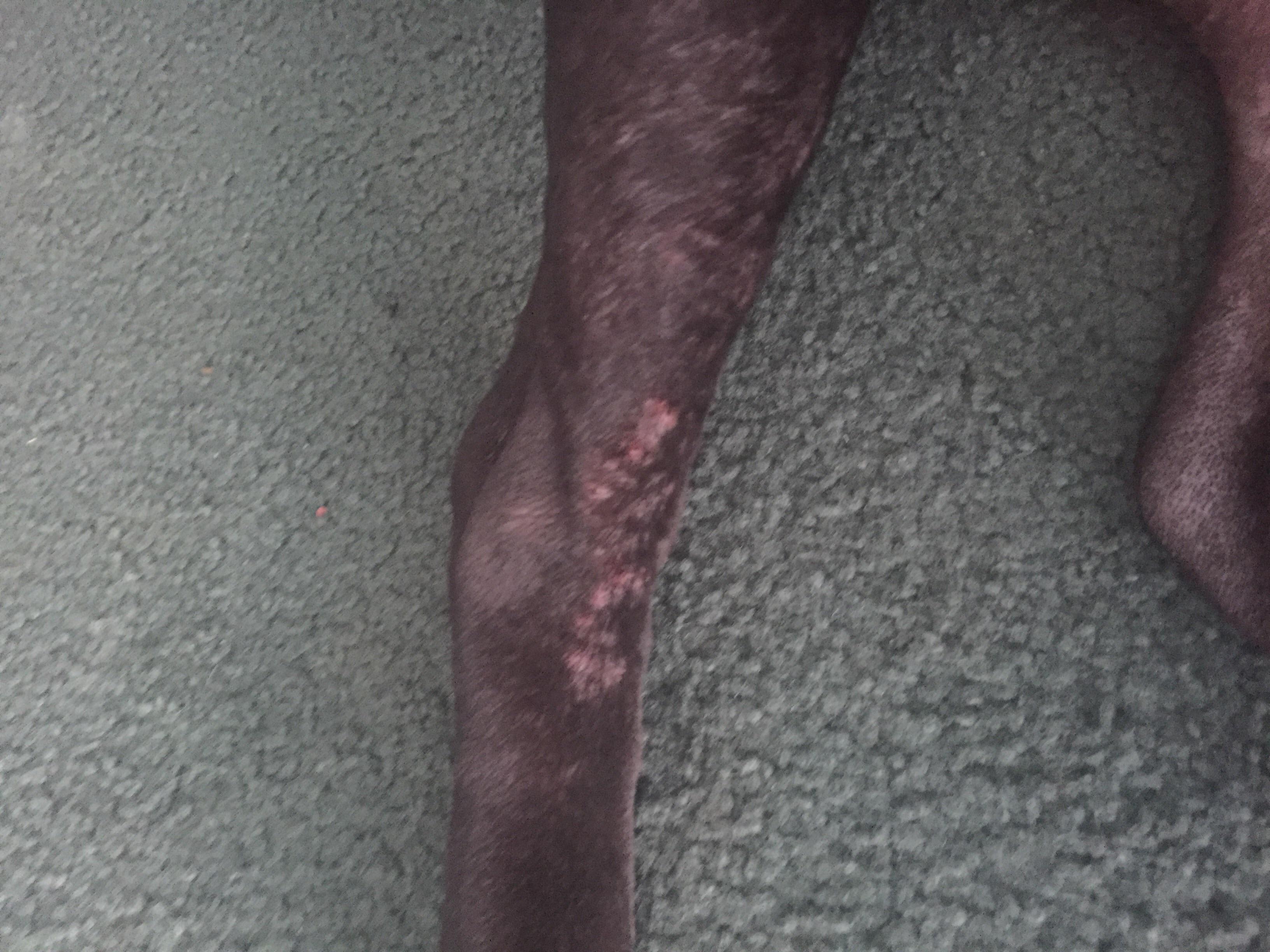 Question details sensitive content