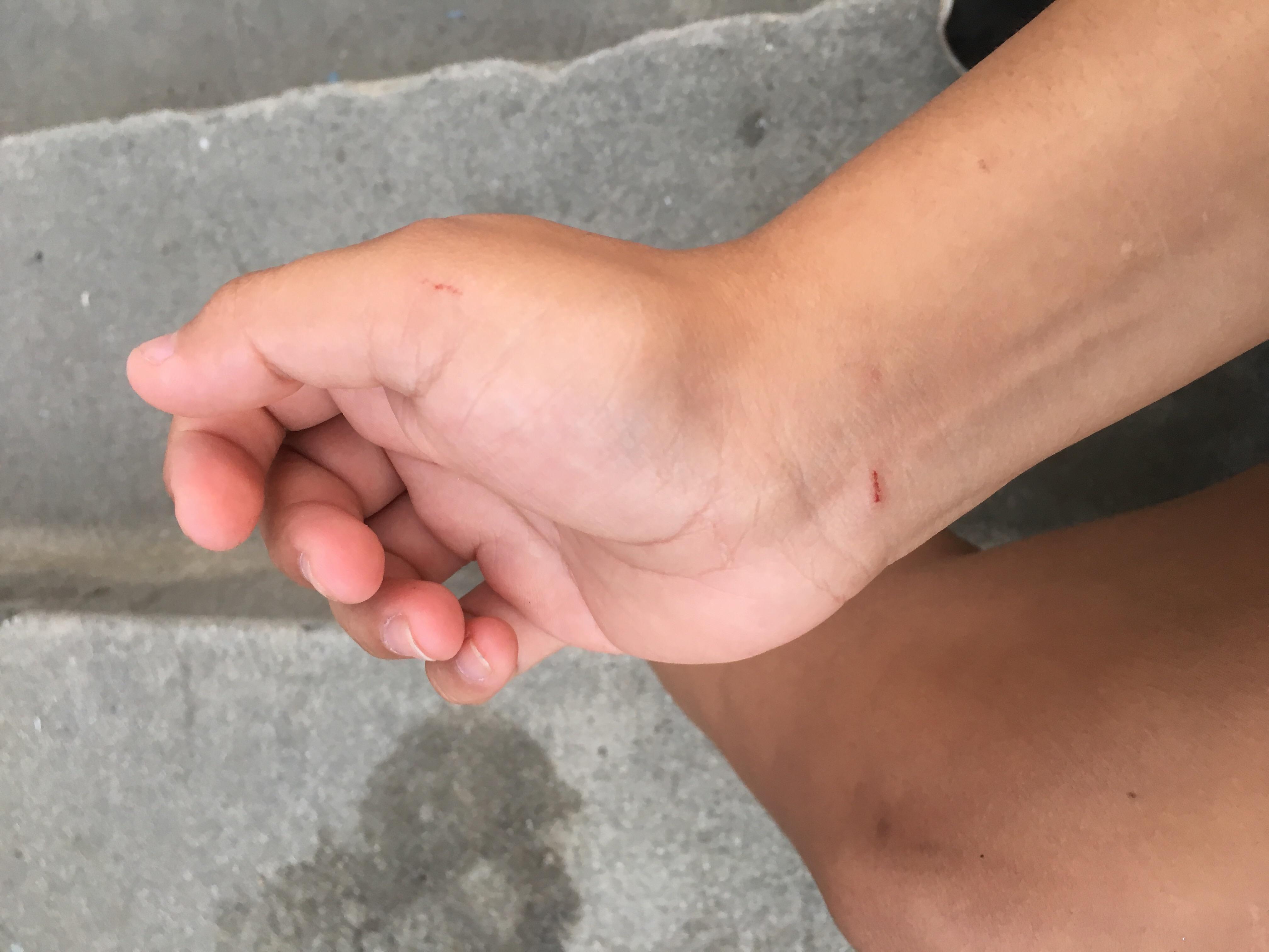 Question details sensitive content