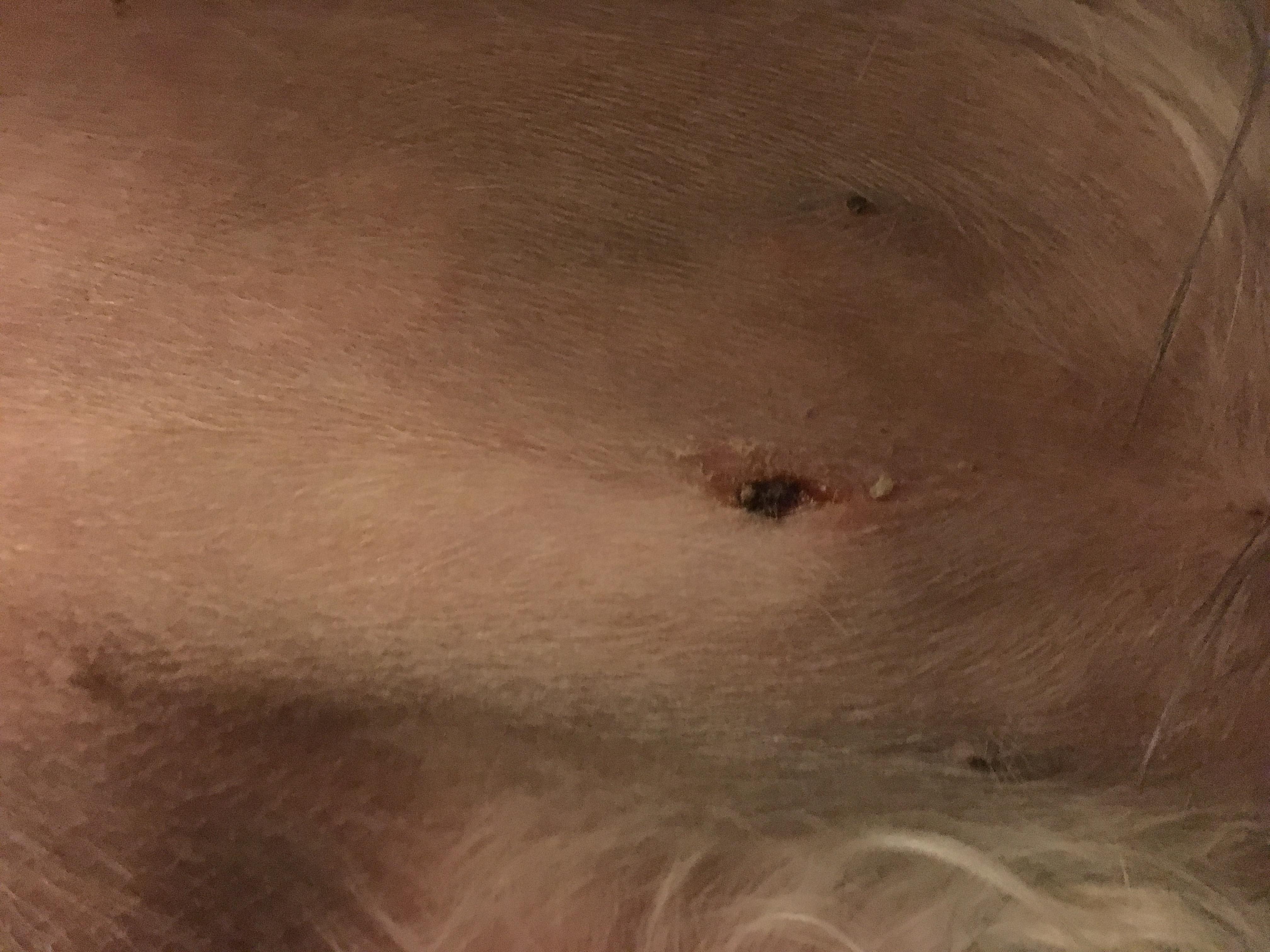 Question details sensitive content