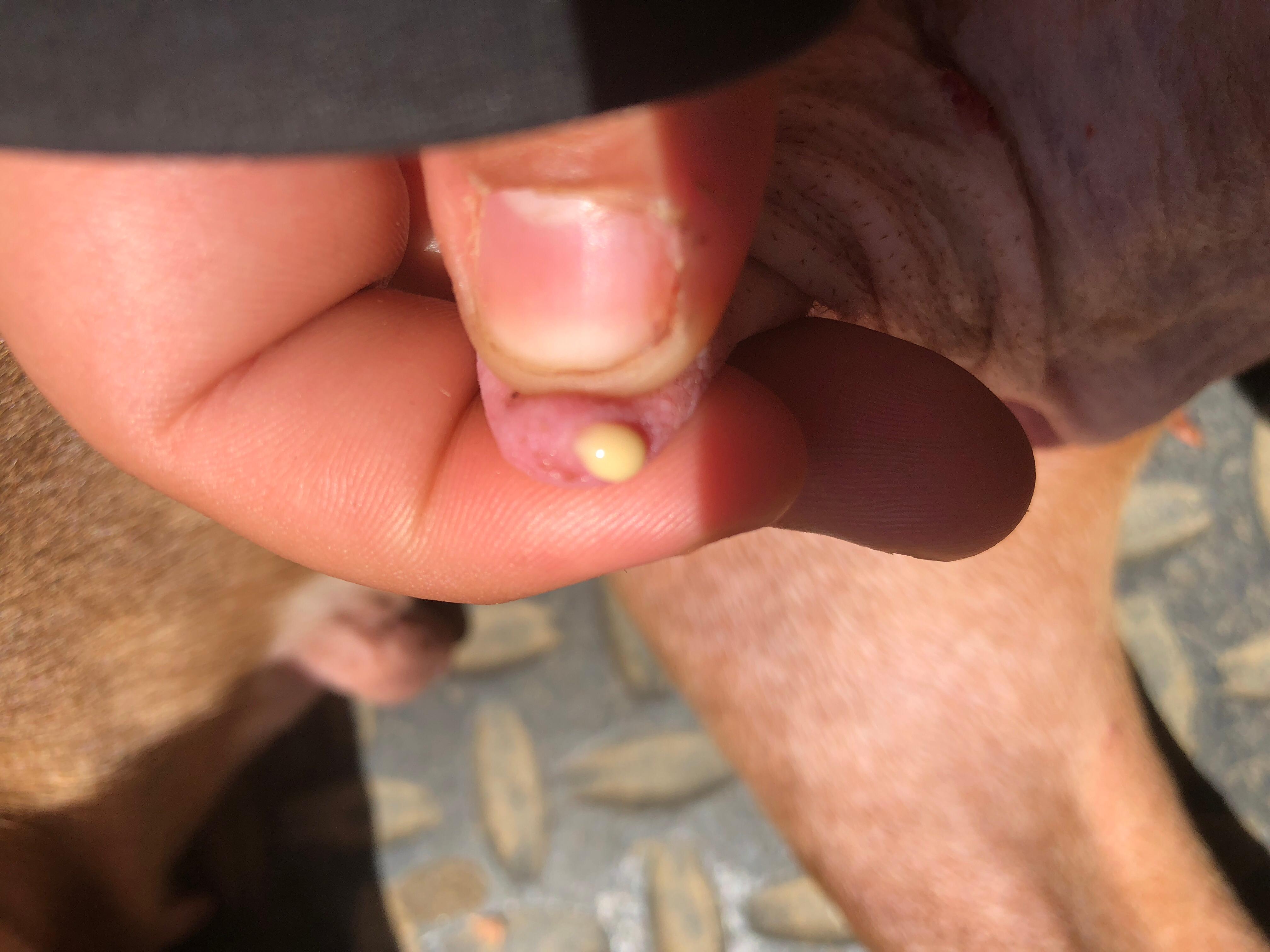 Question details sensitive content