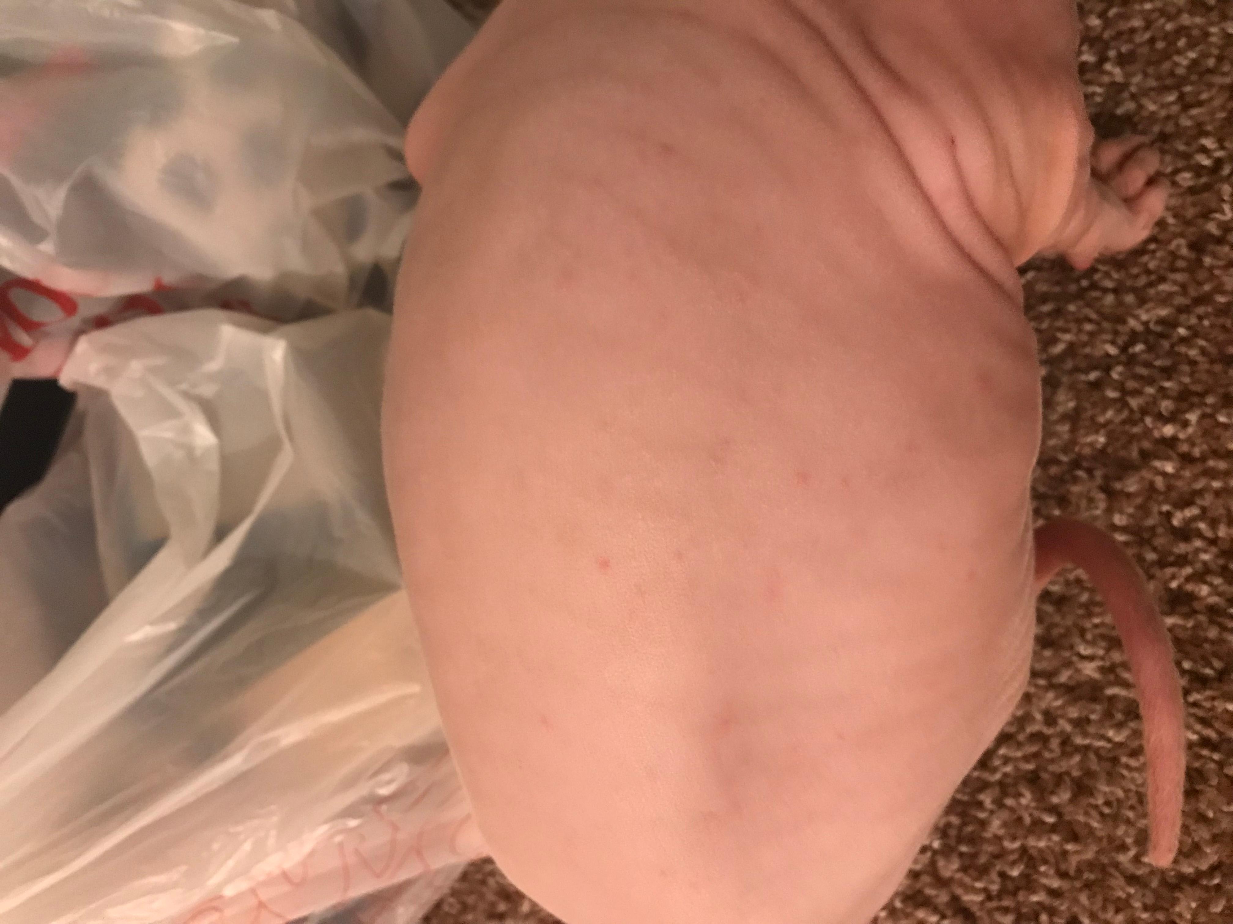 Question details sensitive content