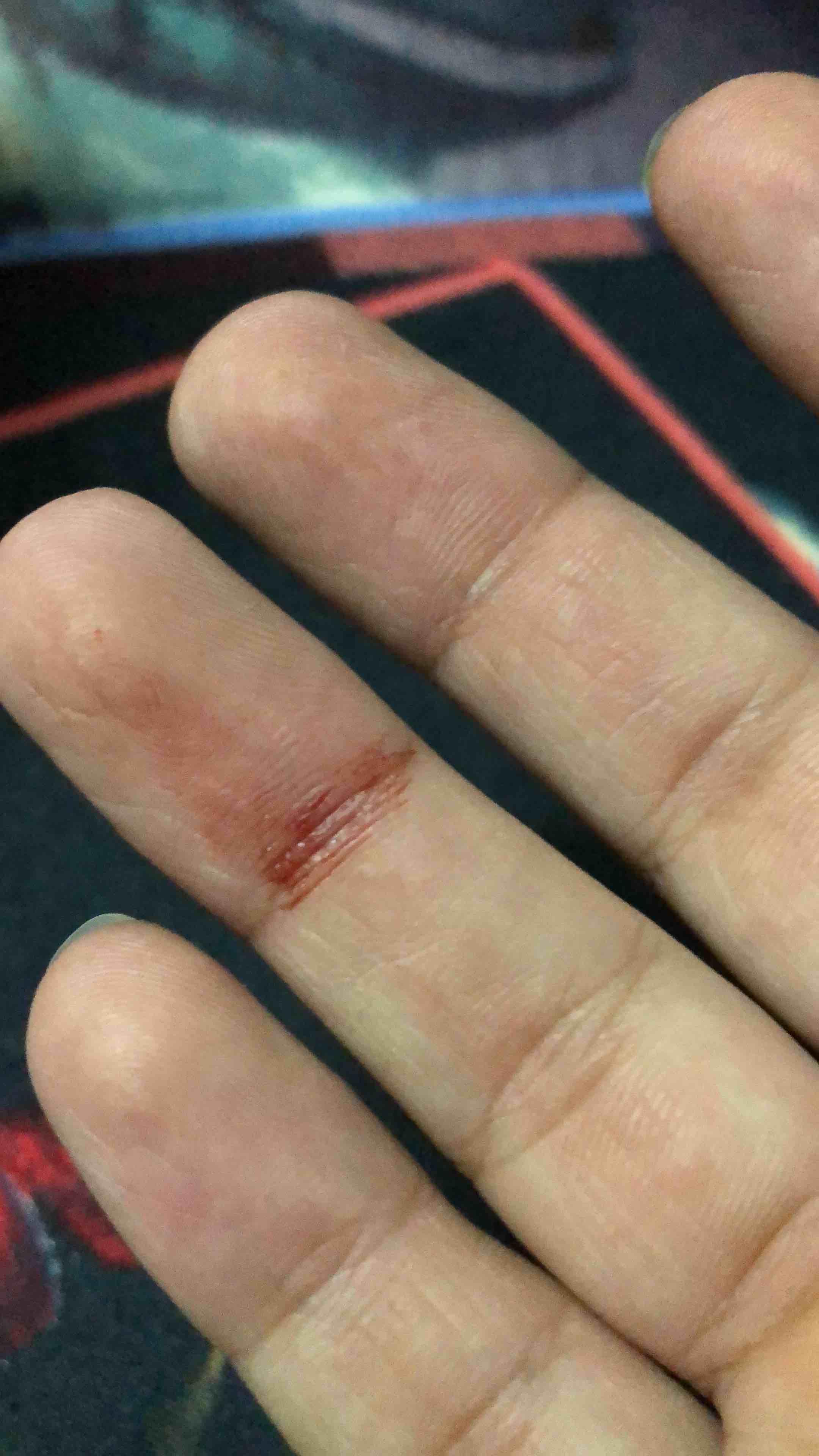 Question details sensitive content