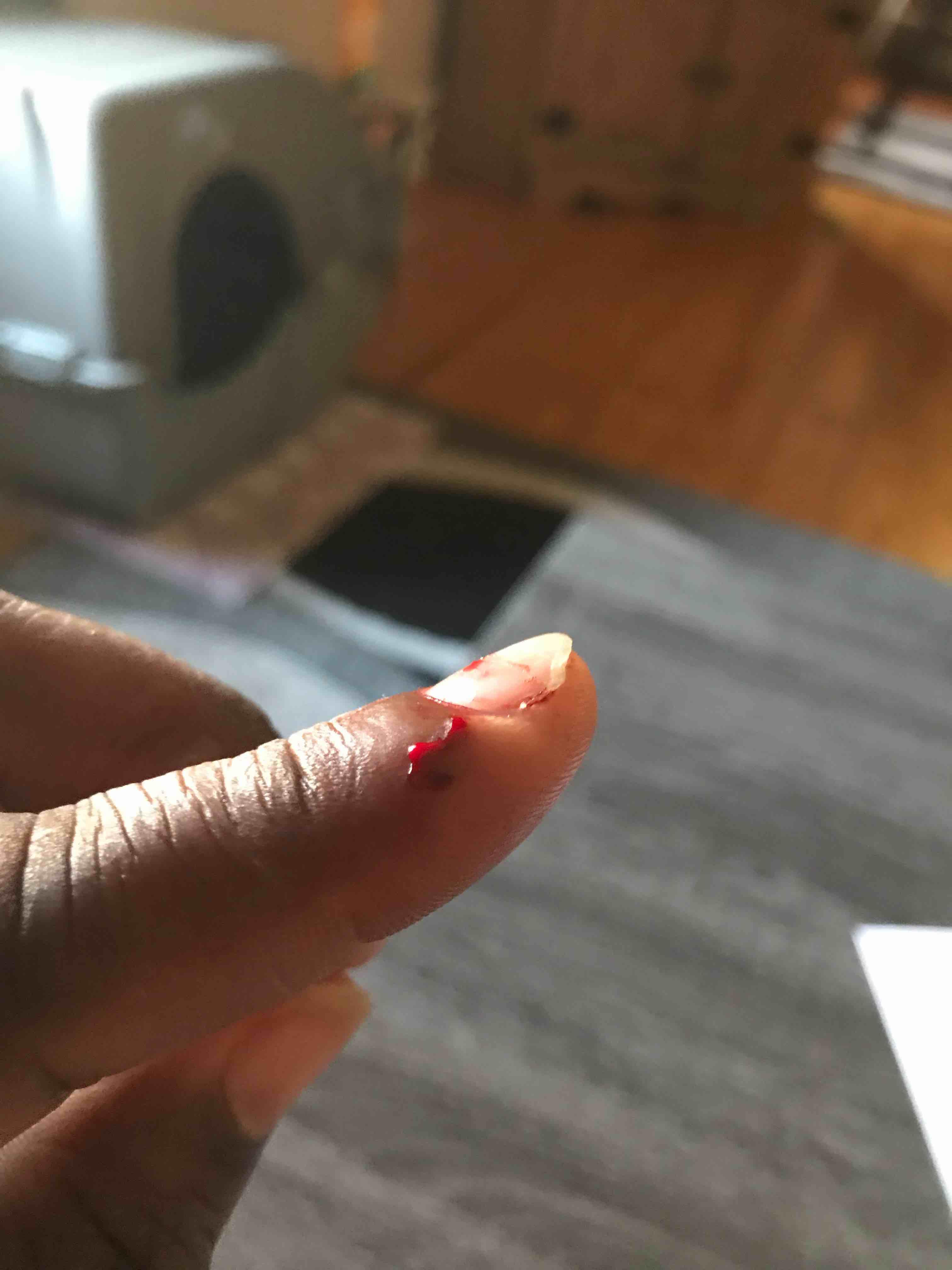 Question details sensitive content