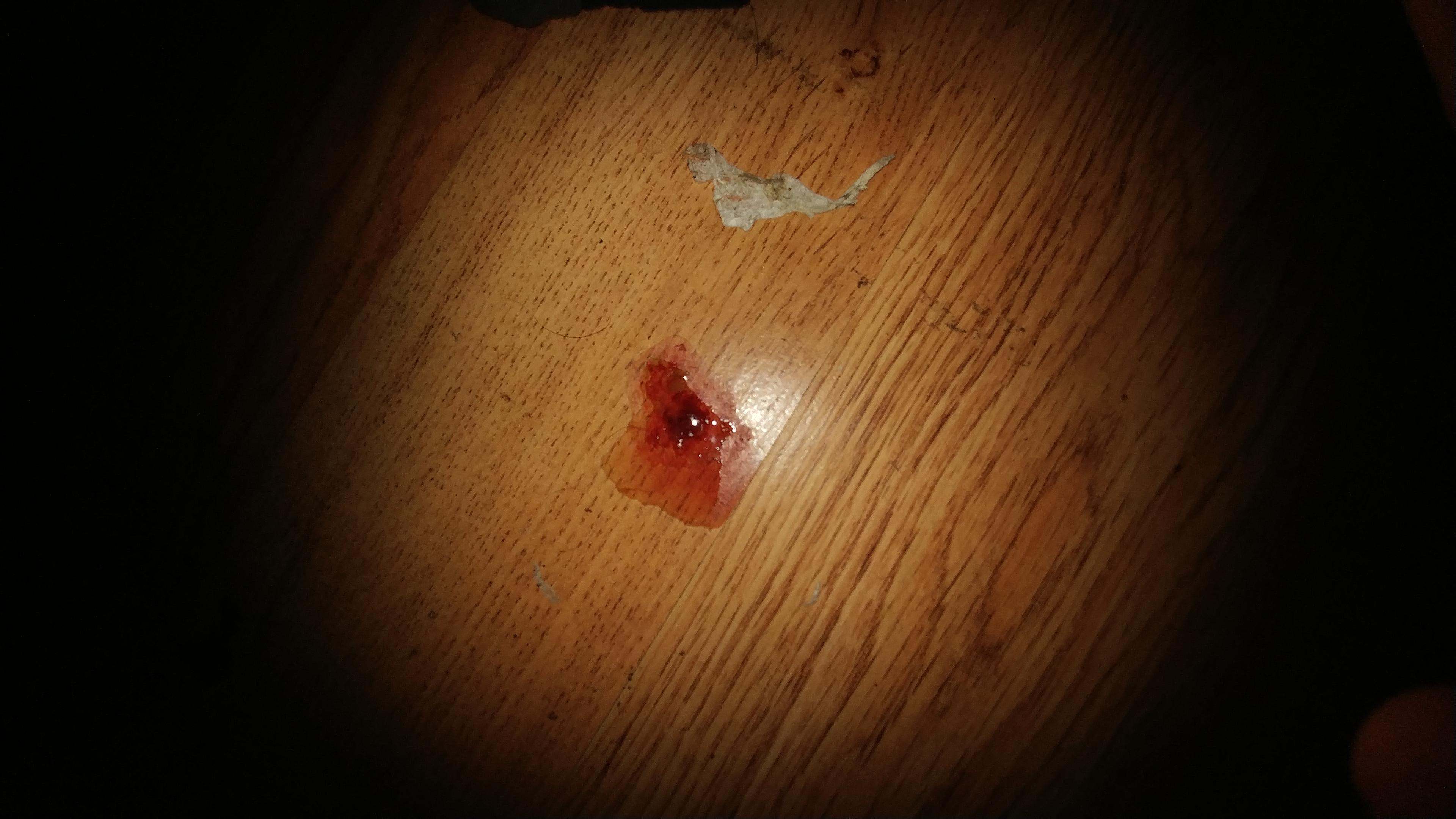 Question details sensitive content