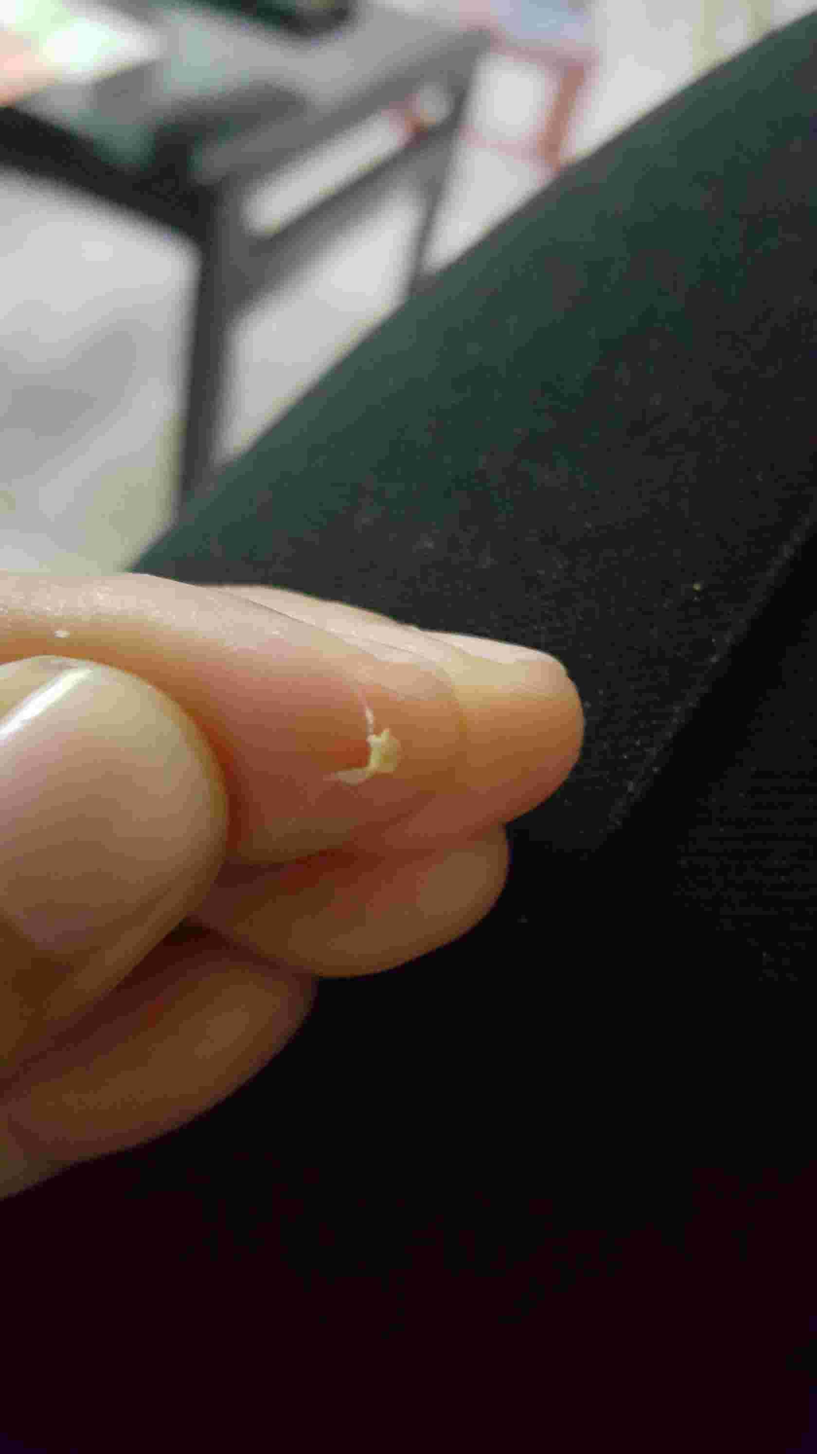 Question details sensitive content