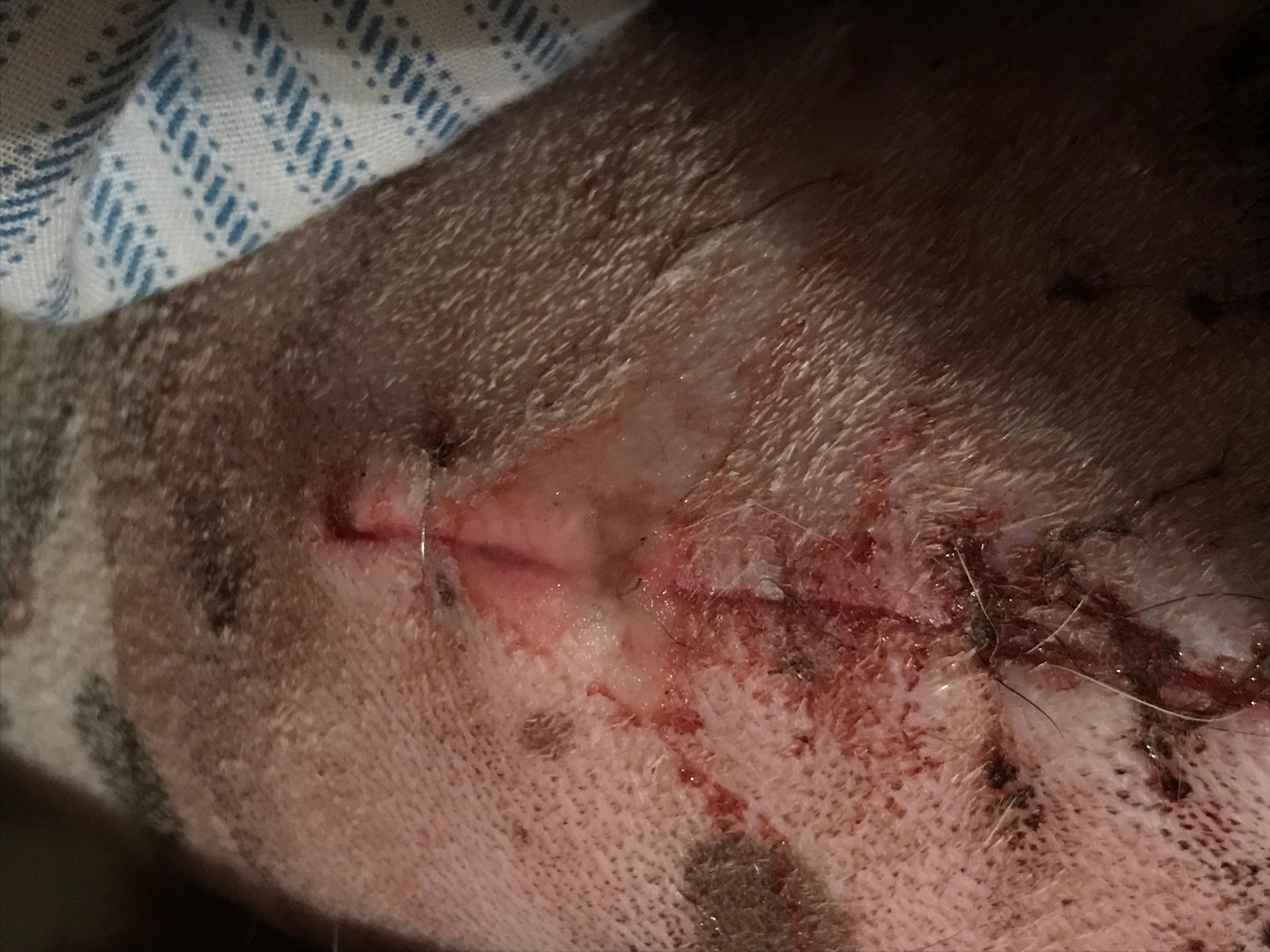 Question details sensitive content