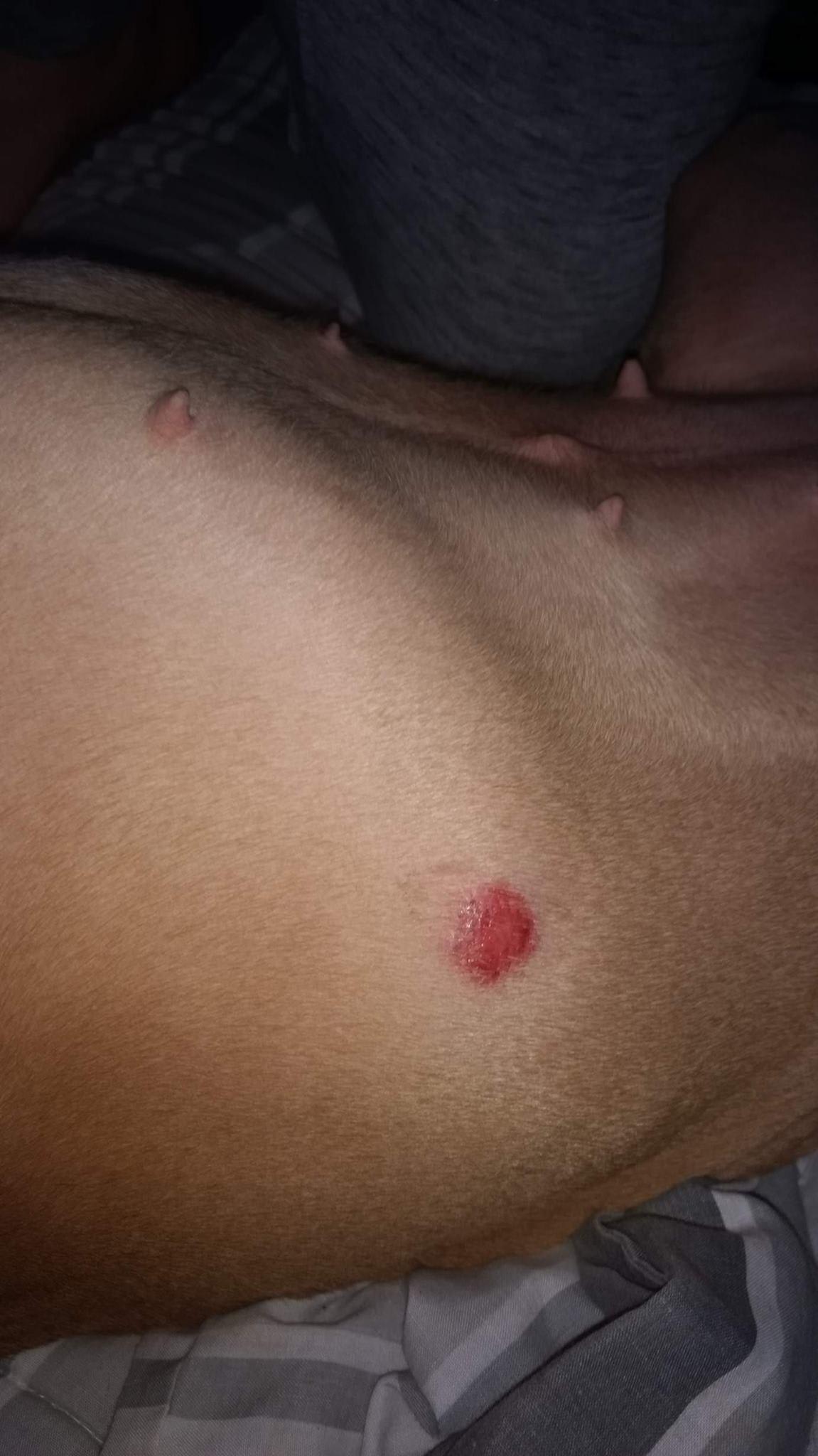 Question details sensitive content