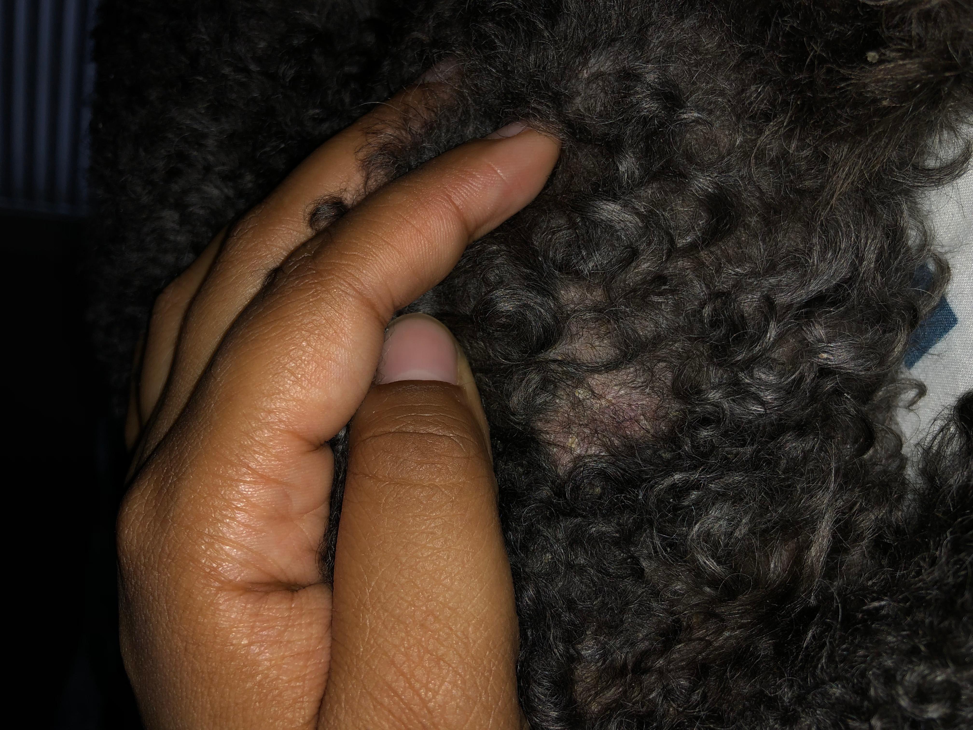 Question details sensitive content