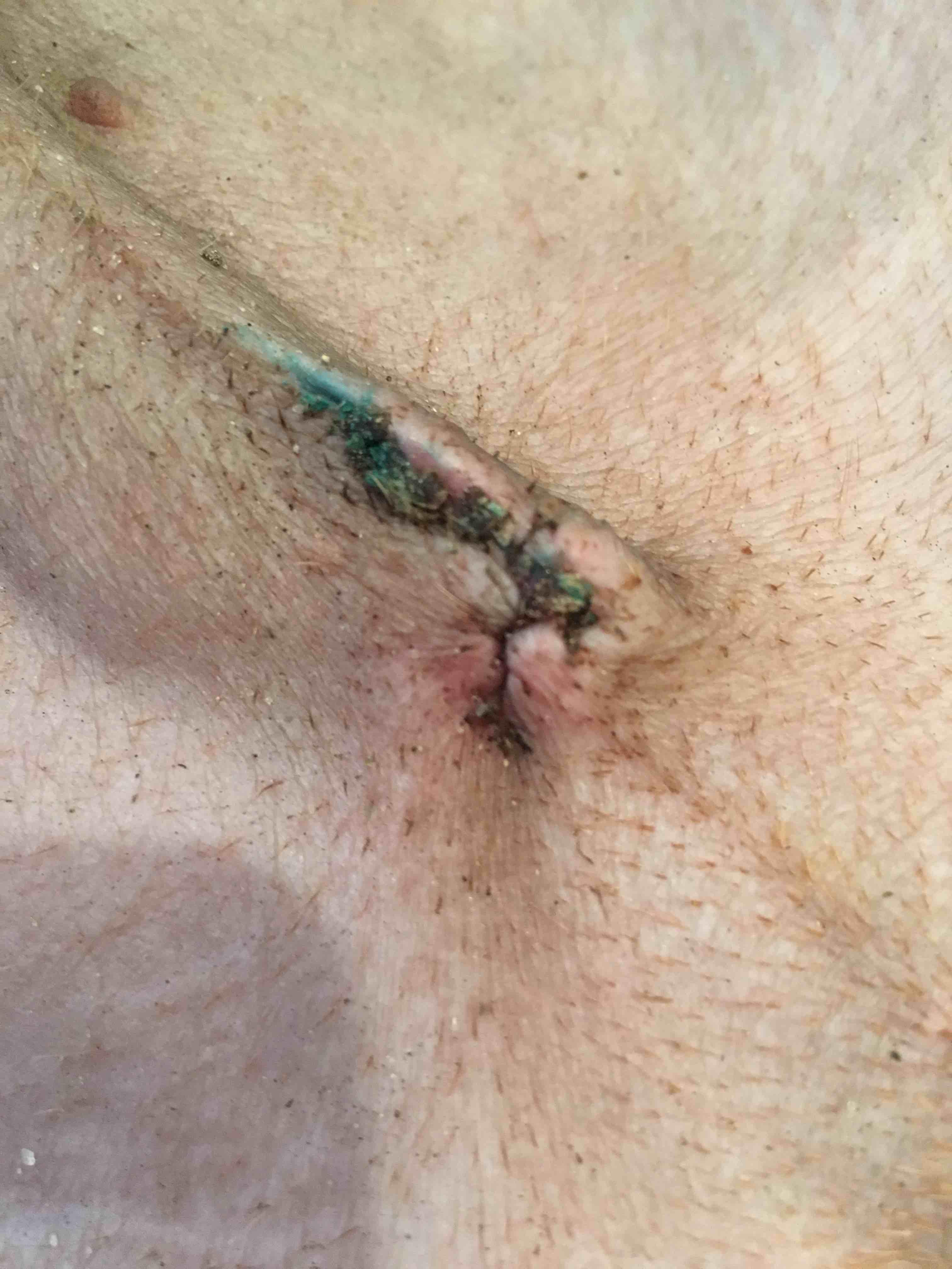 Question details sensitive content