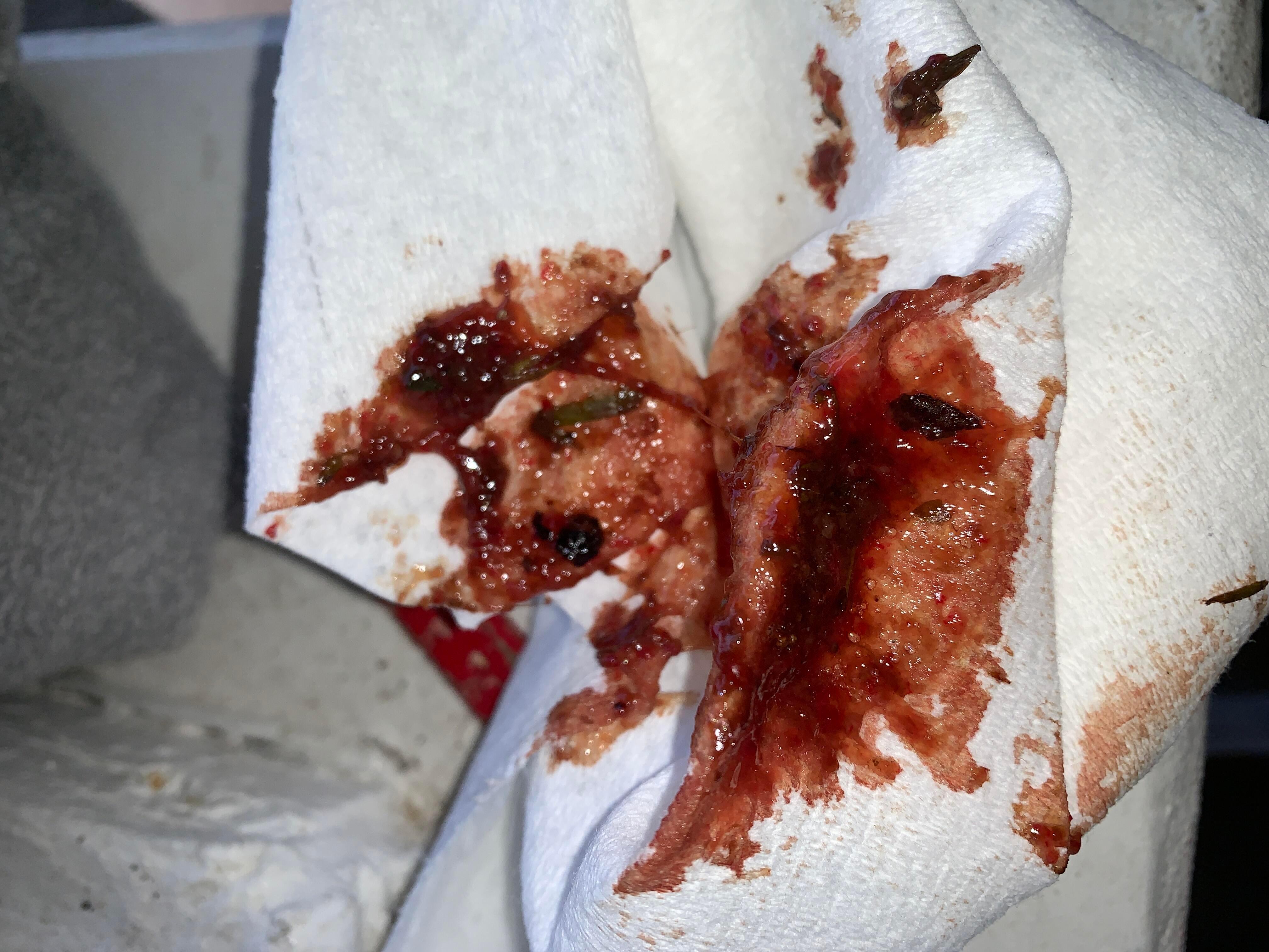 Question details sensitive content