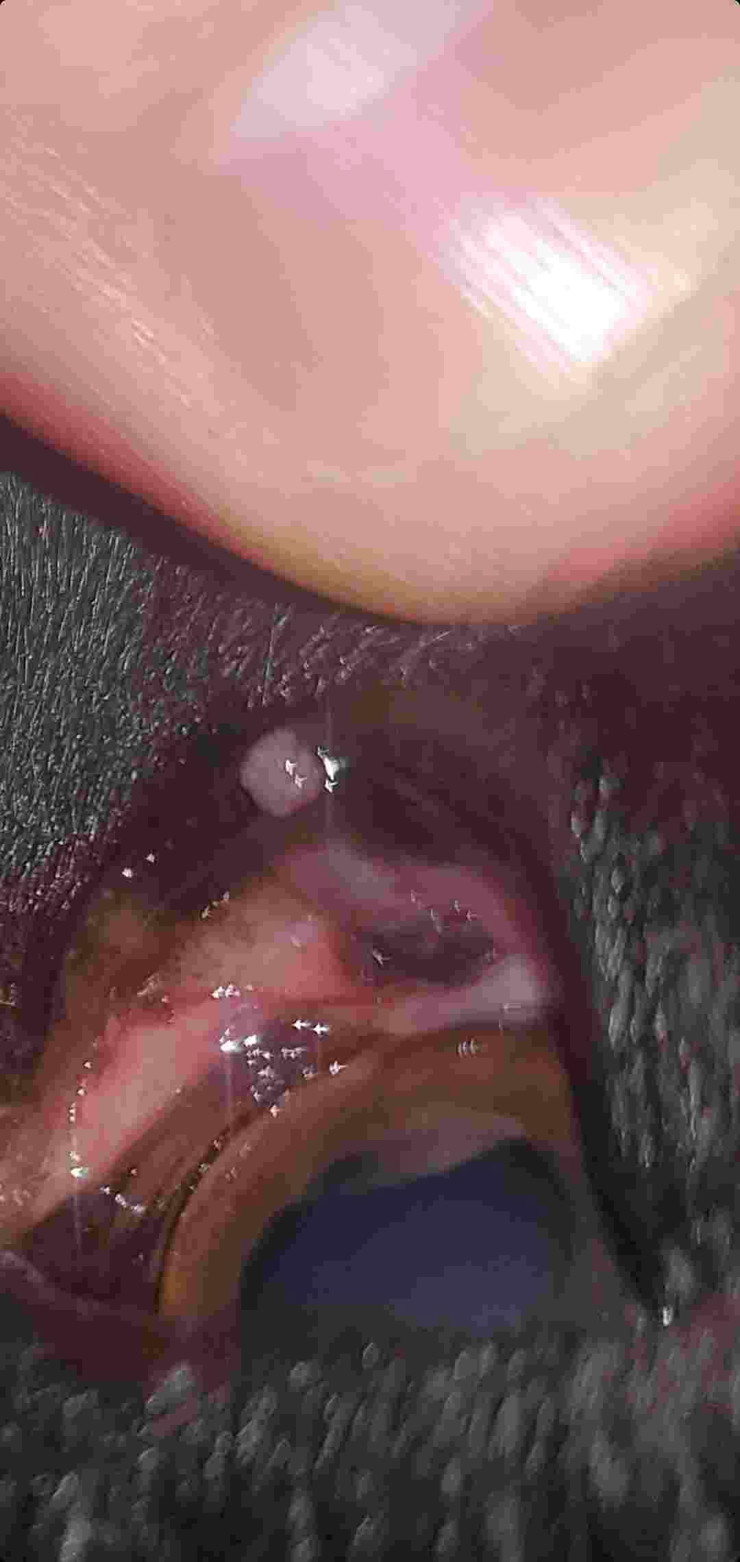 Question details sensitive content