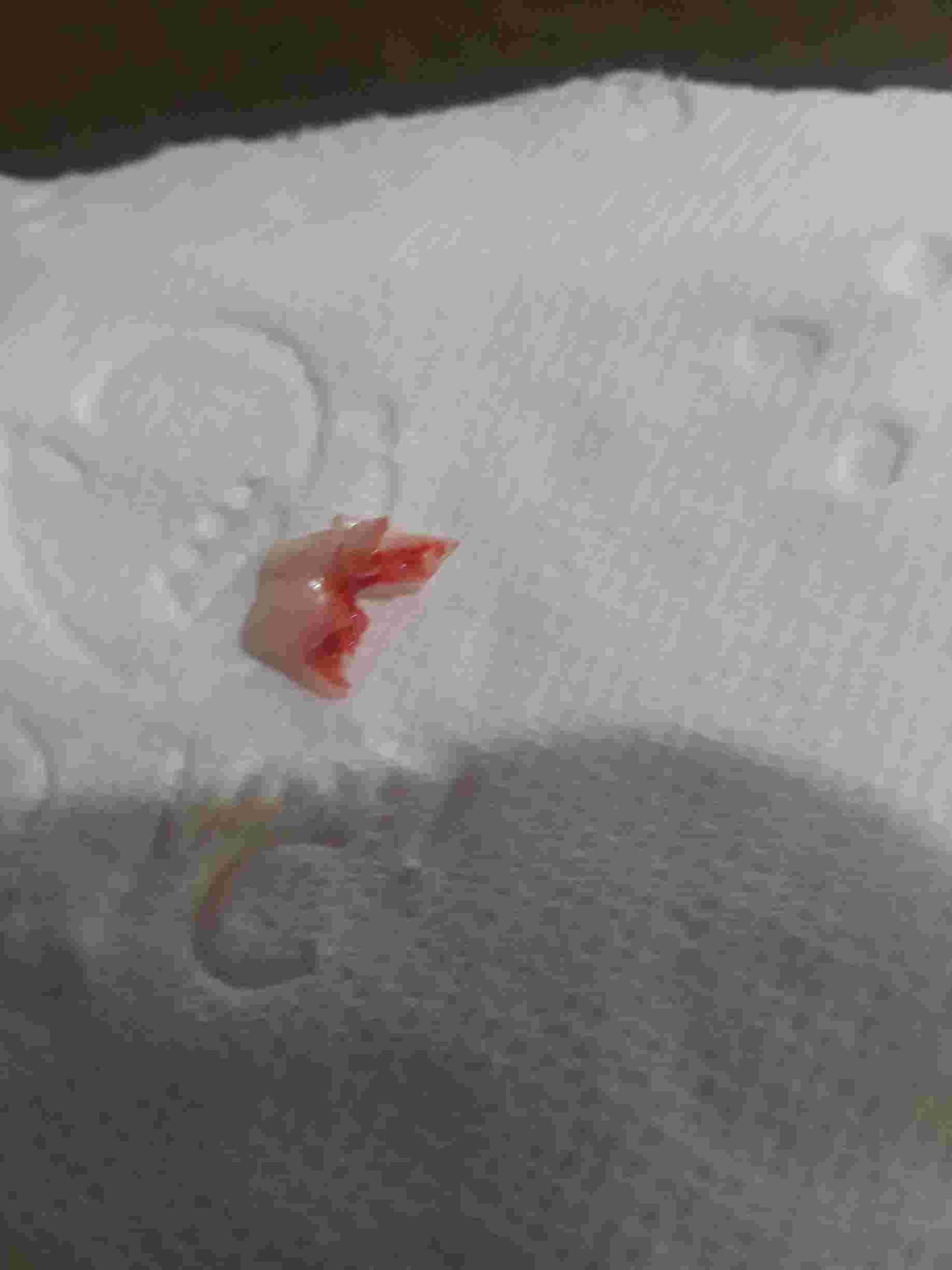 Question details sensitive content