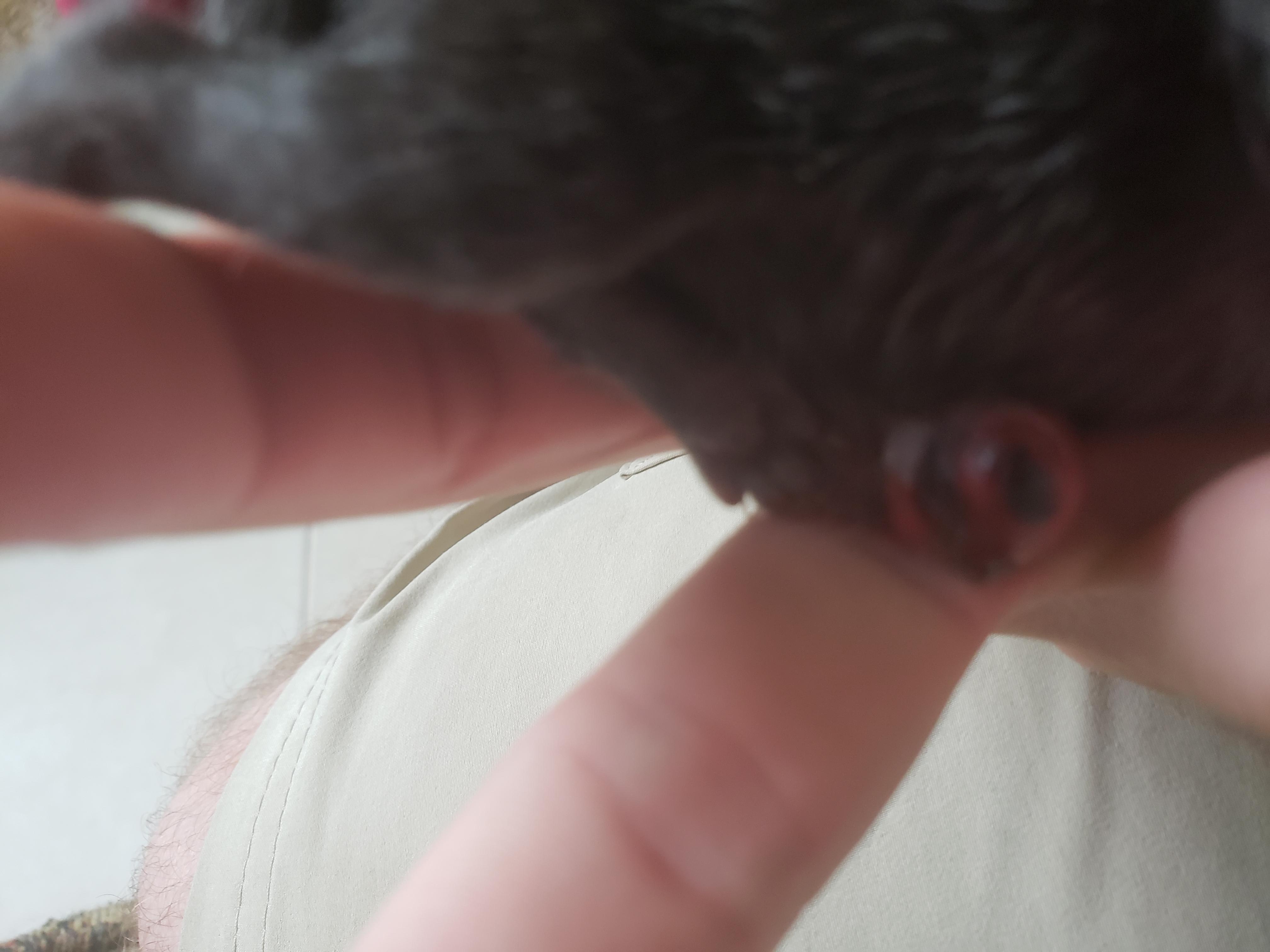 Question details sensitive content