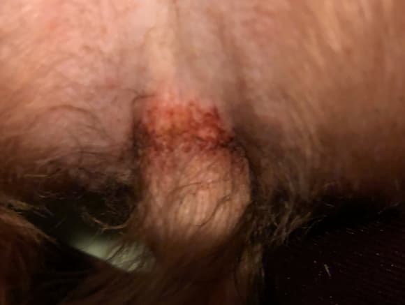 Question details sensitive content